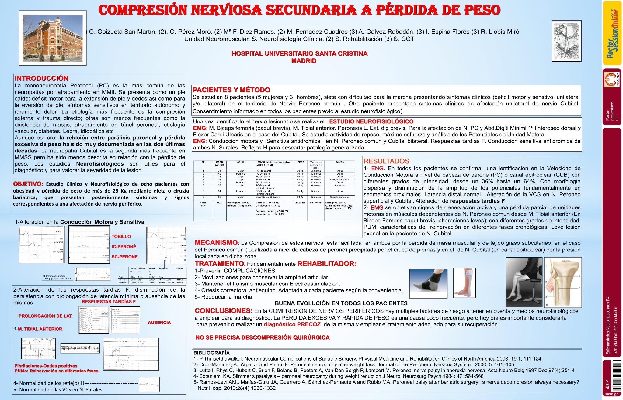 Compresión nerviosa secundaria a pérdida de peso