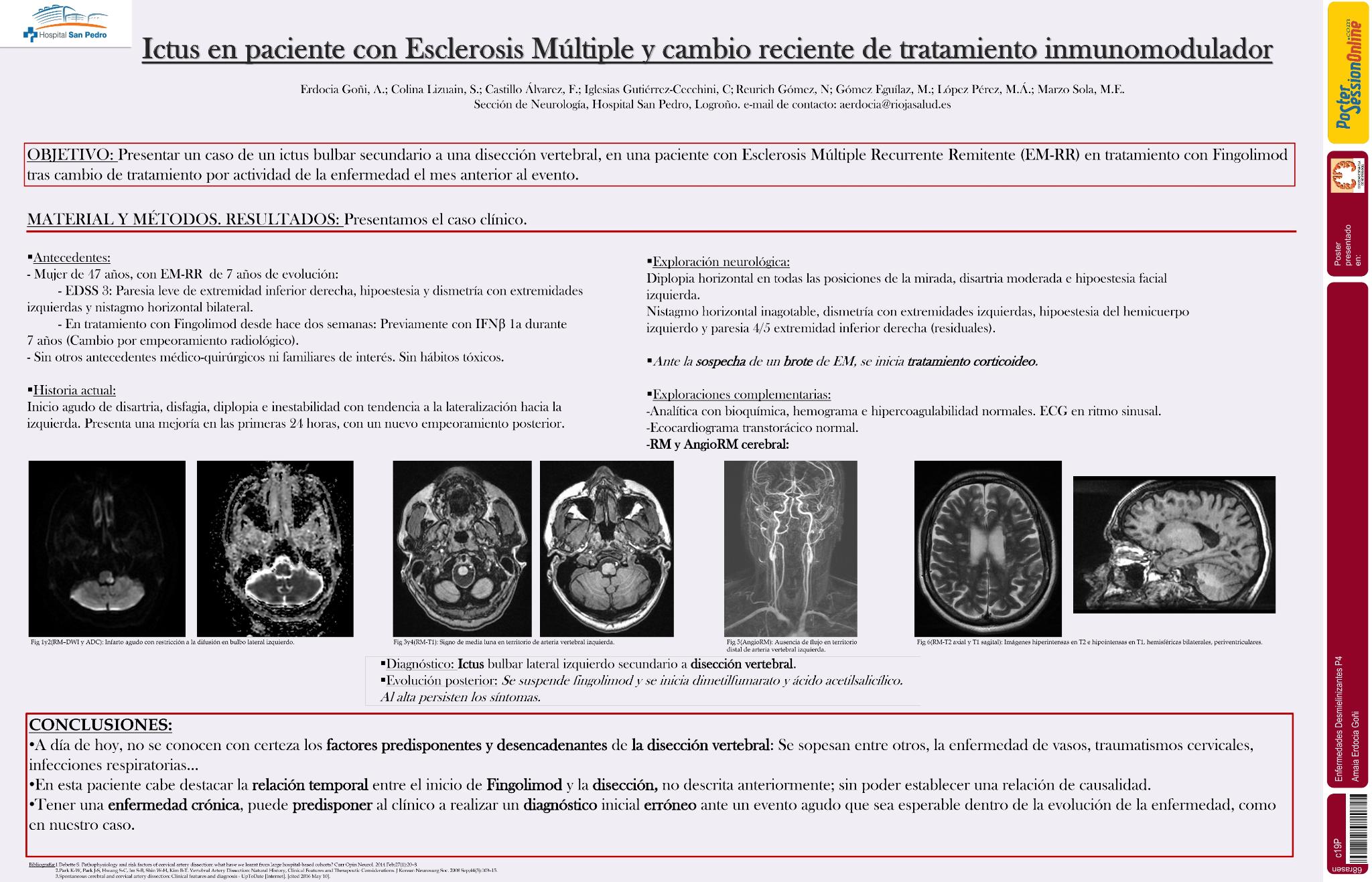 Ictus en paciente con Esclerosis Múltiple y cambio reciente de tratamiento inmunomodulador