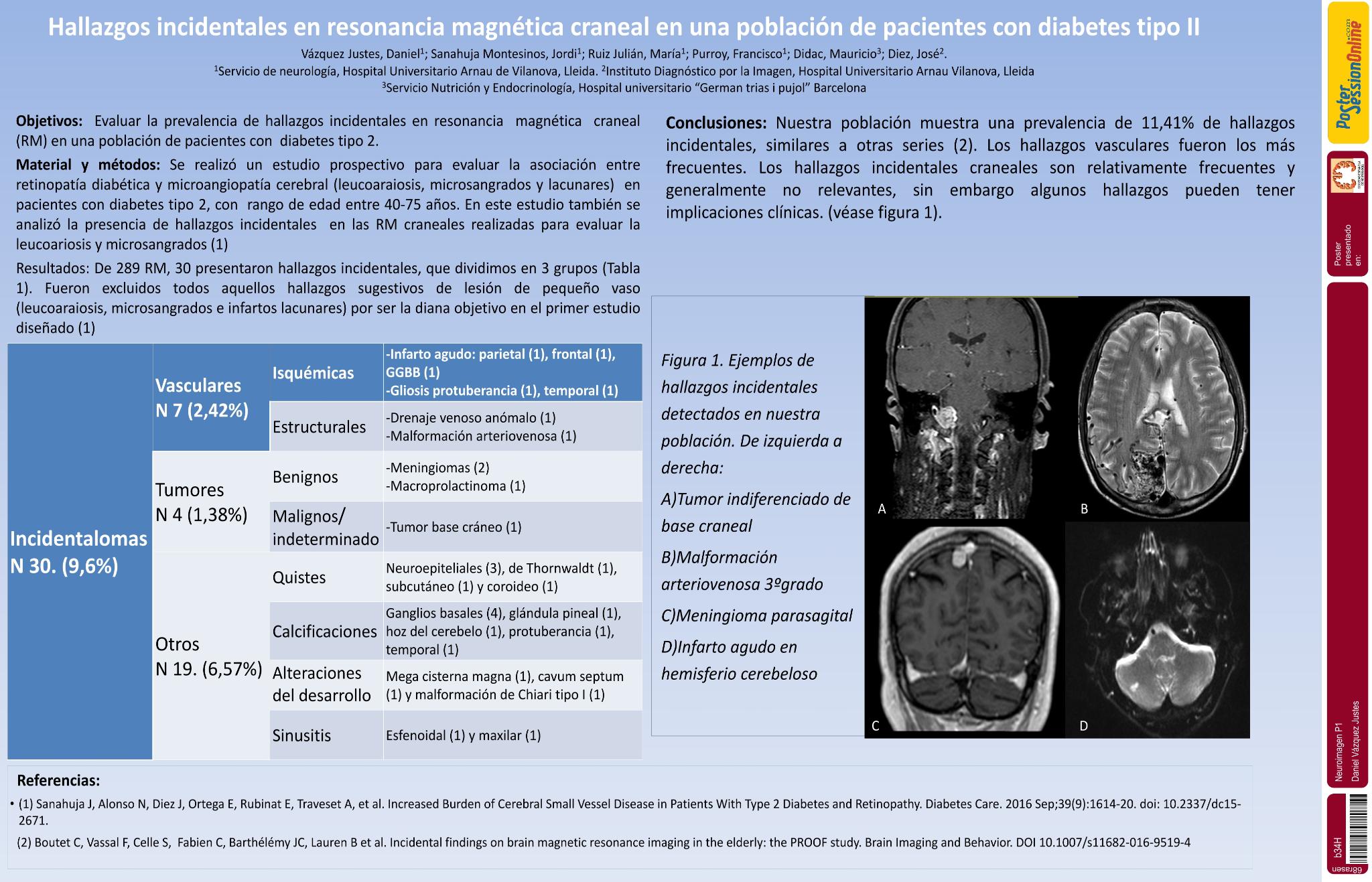Hallazgos incidentales en resonancia magnética craneal en una población de pacientes con diabetes tipo 2