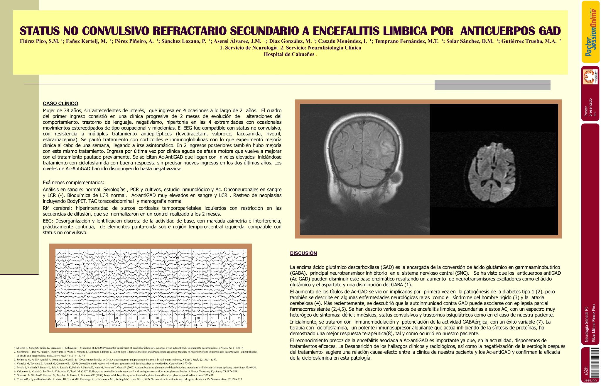 Status no convulsivo refractario secundario a  encefalitis limbica por anticuerpos GAD