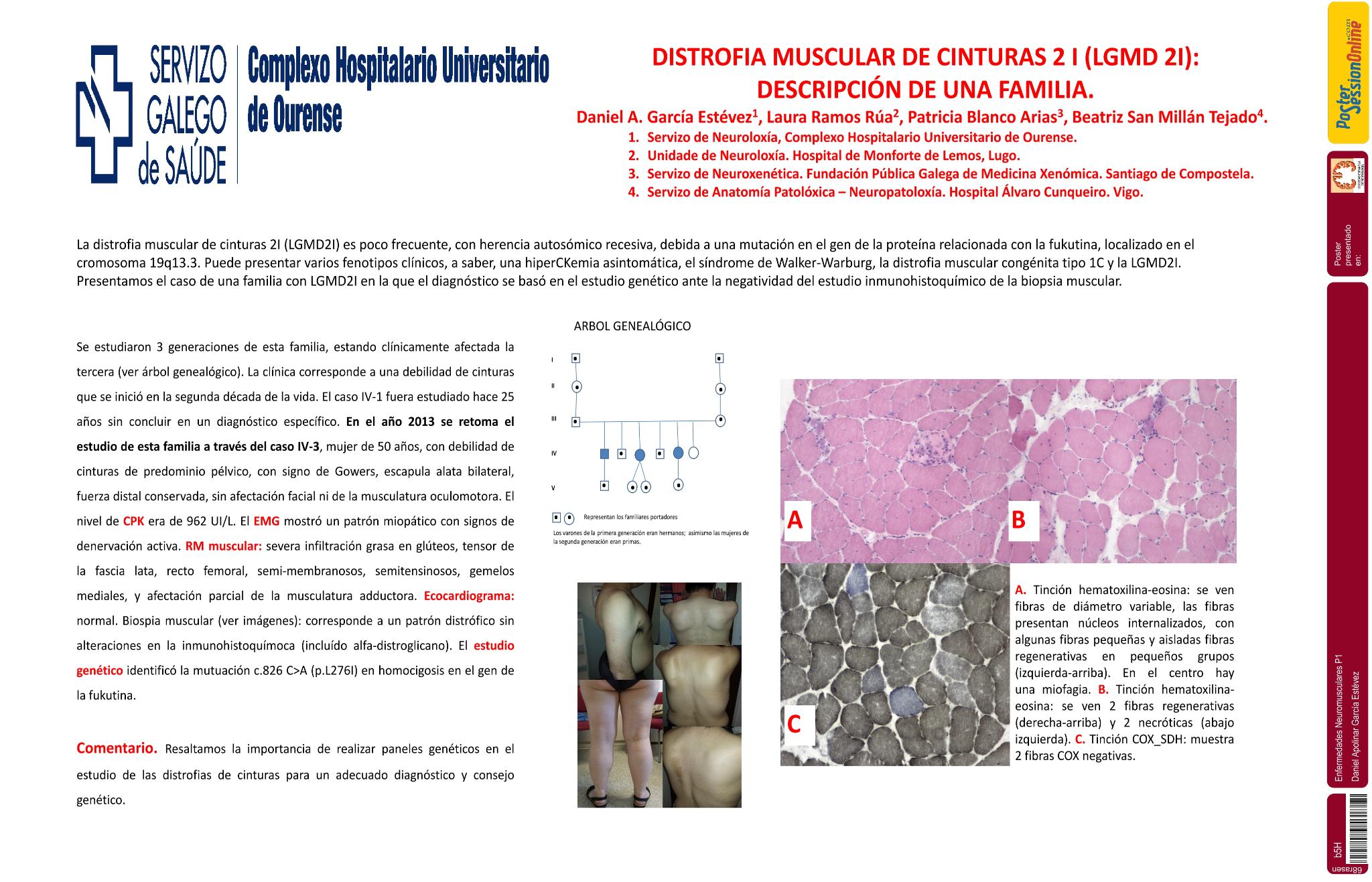 Distrofia muscular de cinturas 2 I: Descripción de una familia