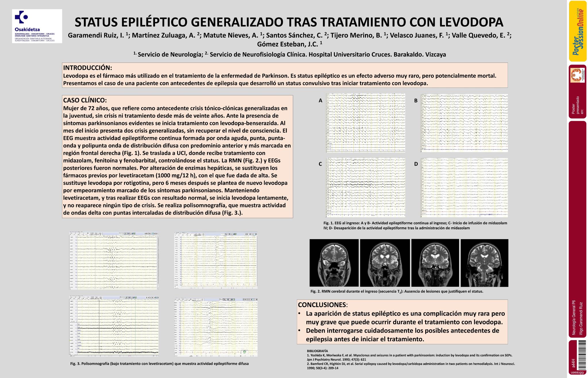 Status epiléptico generalizado tras tratamiento con levodopa