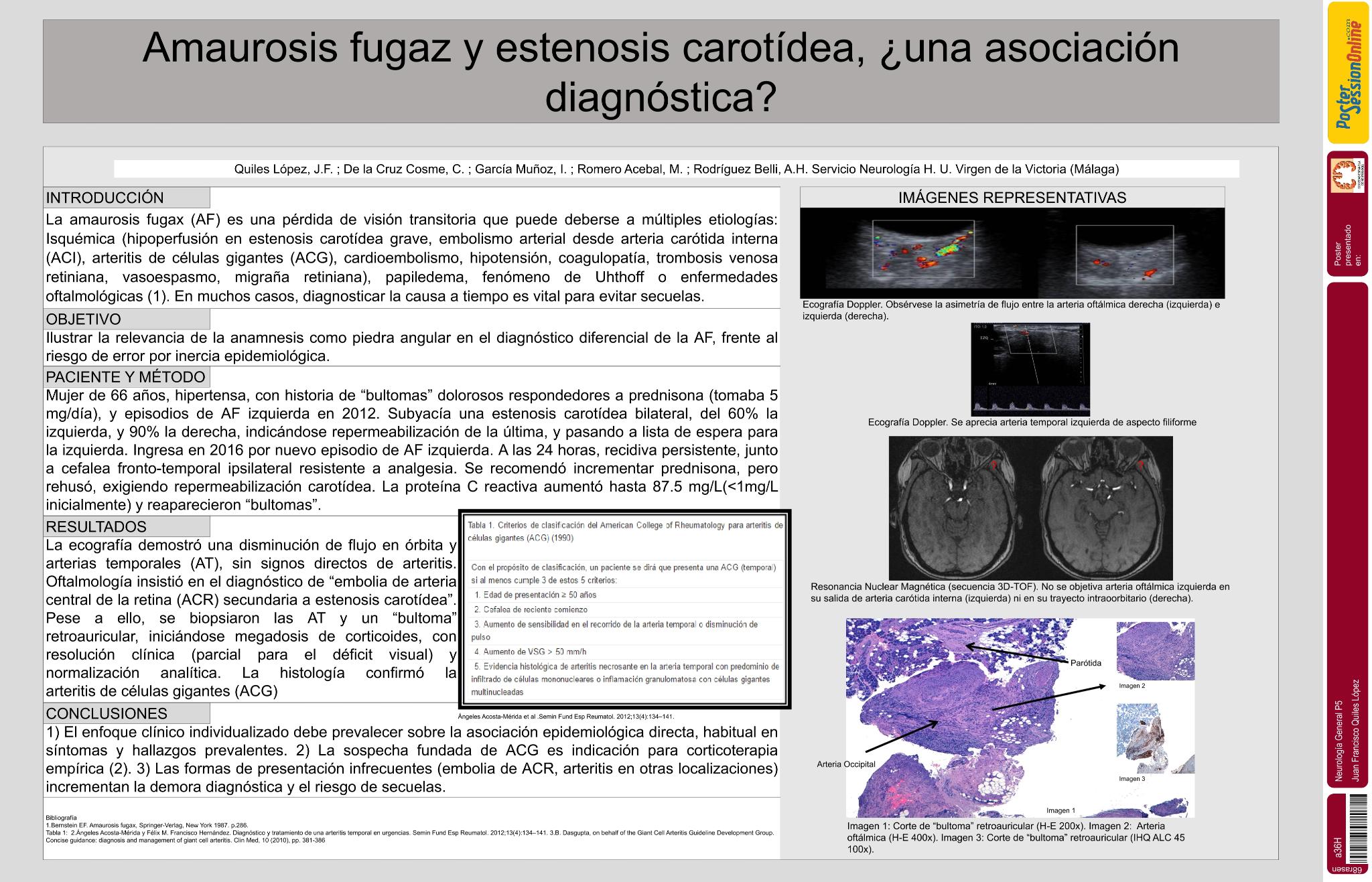 Amaurosis fugaz y estenosis carotídea, ¿una asociación diagnóstica?