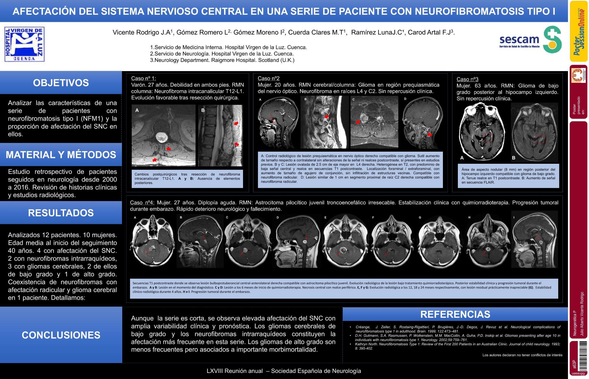 Afectación del sistema nervioso central en una serie de paciente con neurofibromatosis tipo I