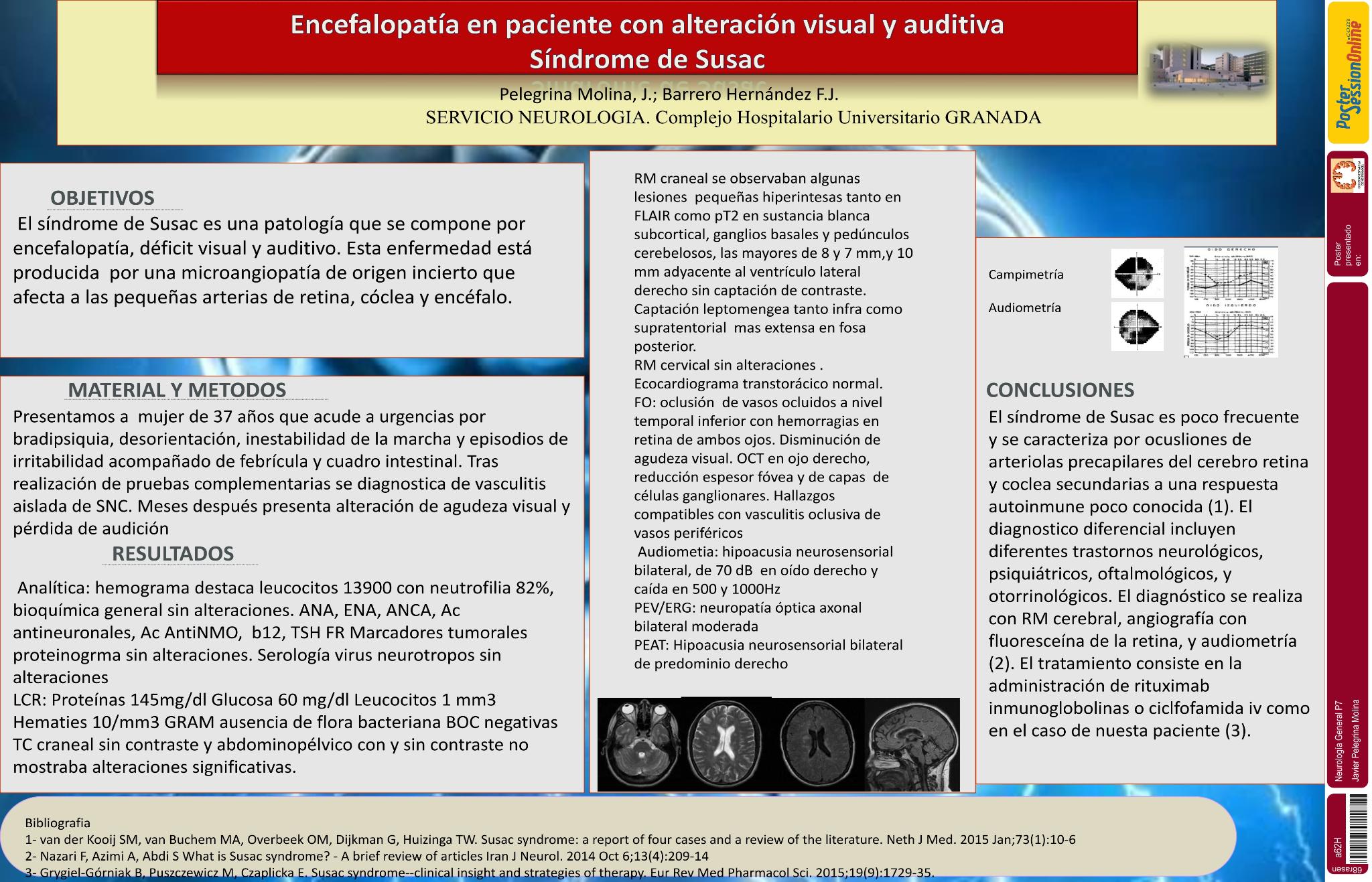 Encefalopatía en paciente con alteración visual y auditiva. Sindrome de Susac