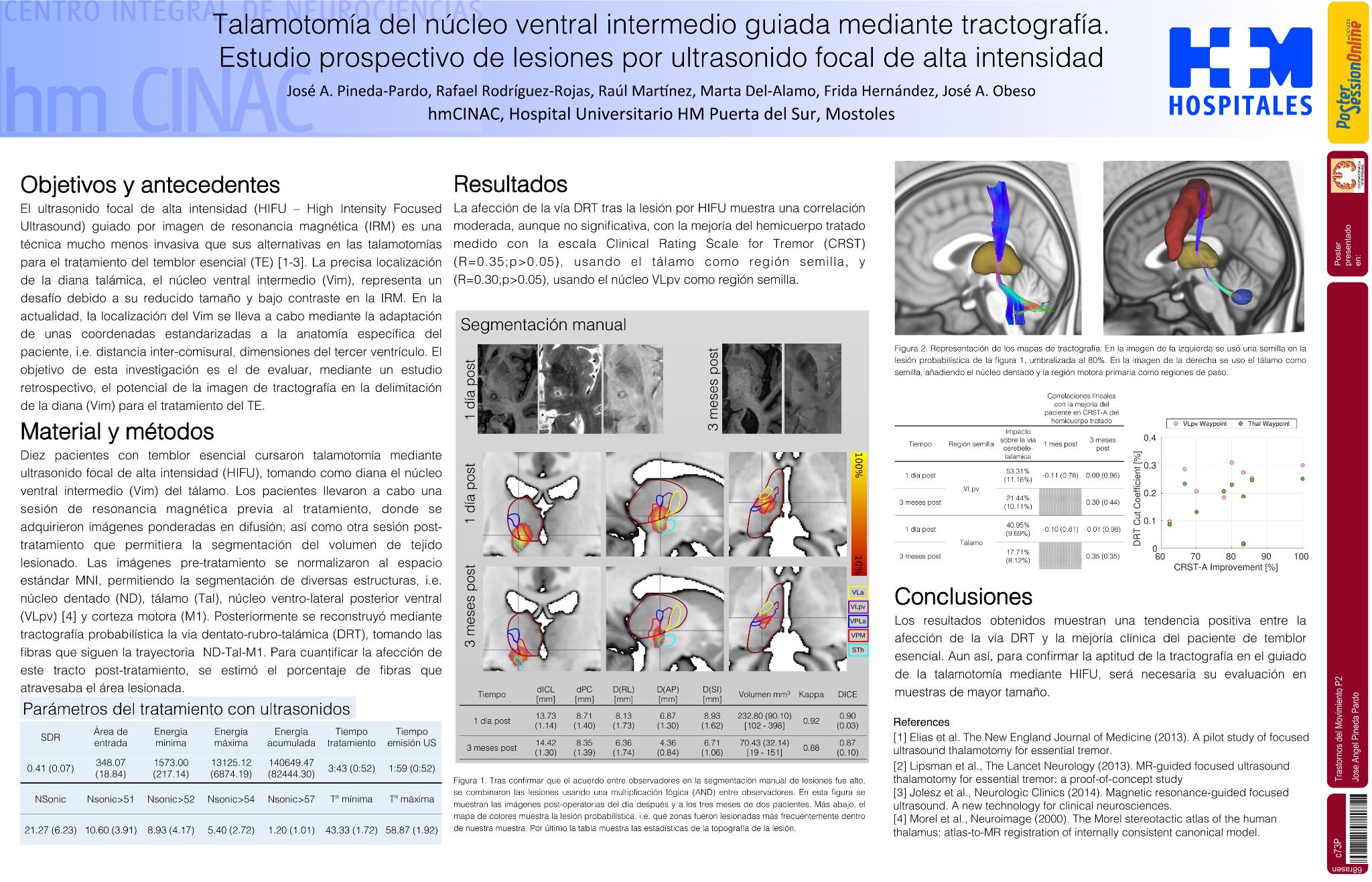 Talamotomía del núcleo ventral intermedio guiada mediante tractografía. Estudio prospectivo de lesiones por ultrasonido focal de alta intensidad