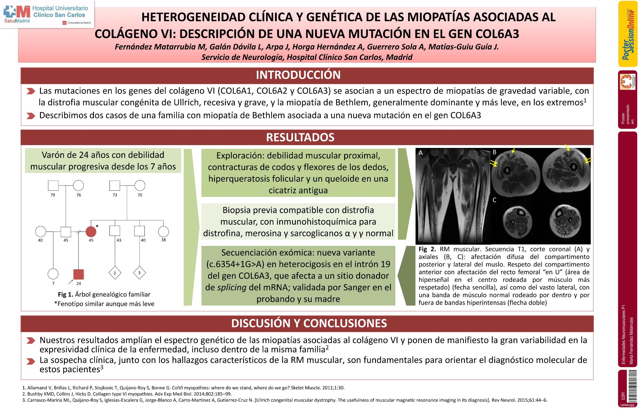 Heterogeneidad clínica y genética de las miopatías asociadas al colágeno VI: descripción de una nueva mutación en el gen COL6A3