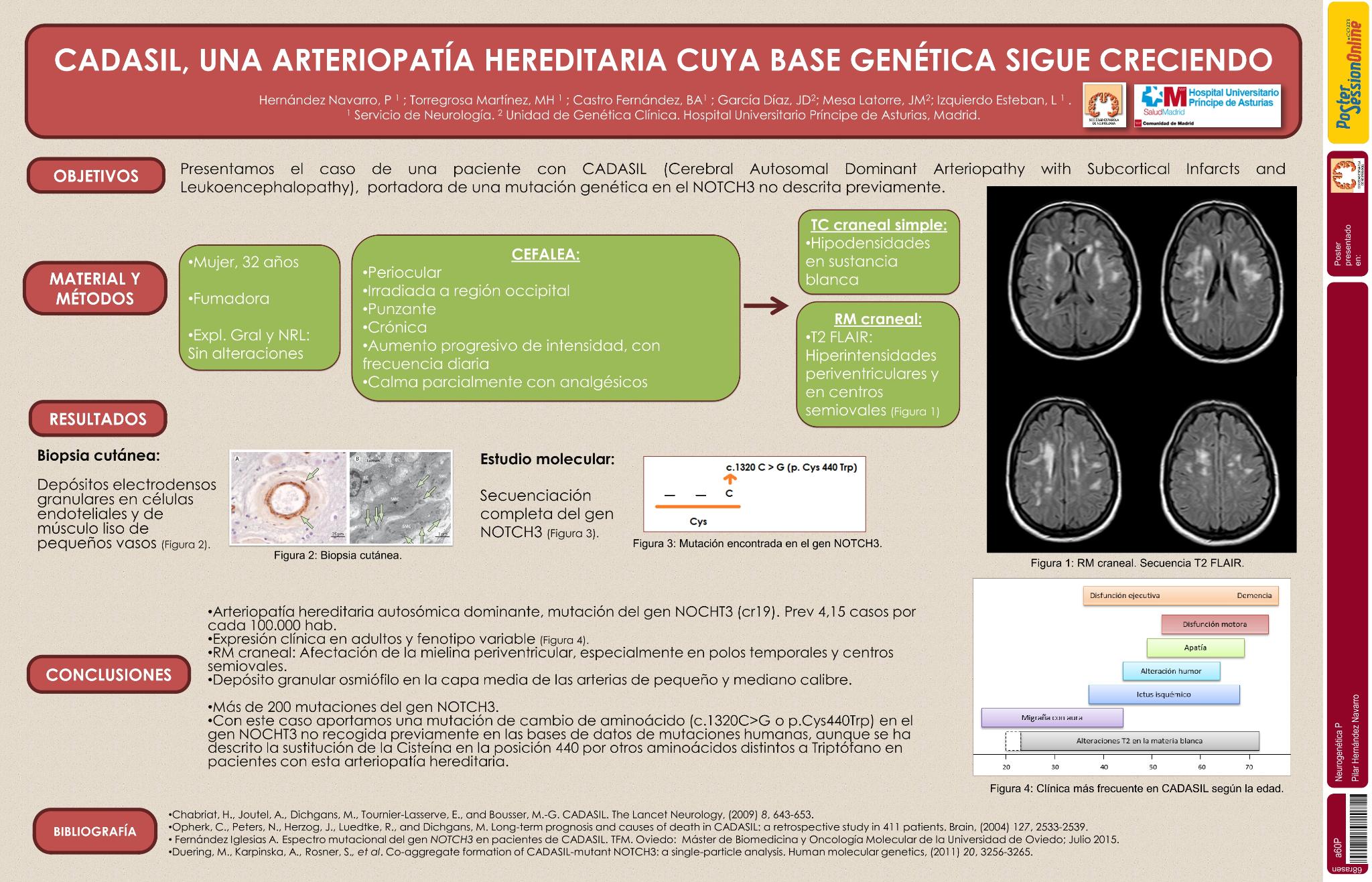 CADASIL, una arteriopatía hereditaria cuya base genética sigue creciendo