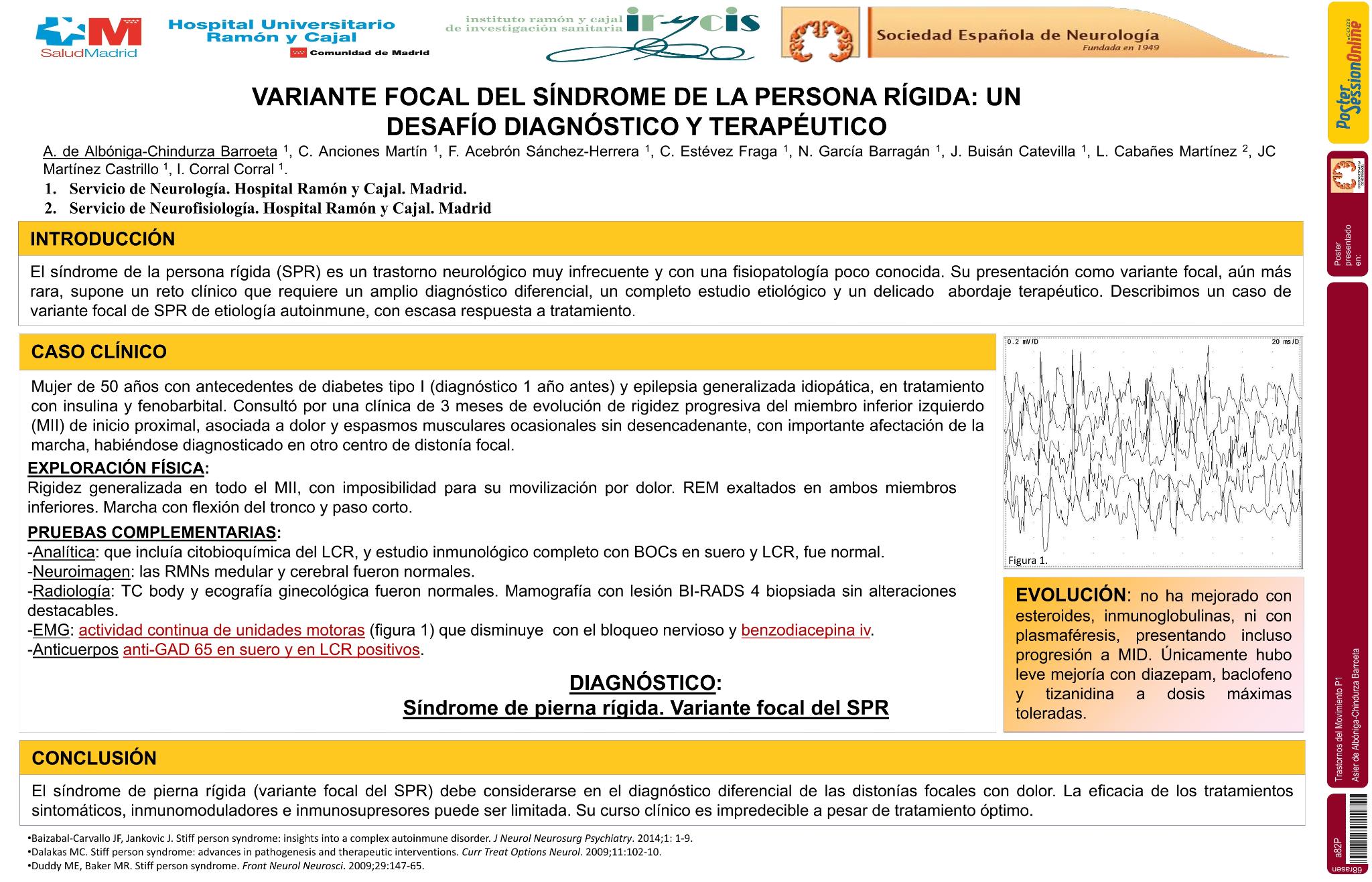 Variante focal del síndrome de la persona rígida: un reto diagnóstico y terapéutico