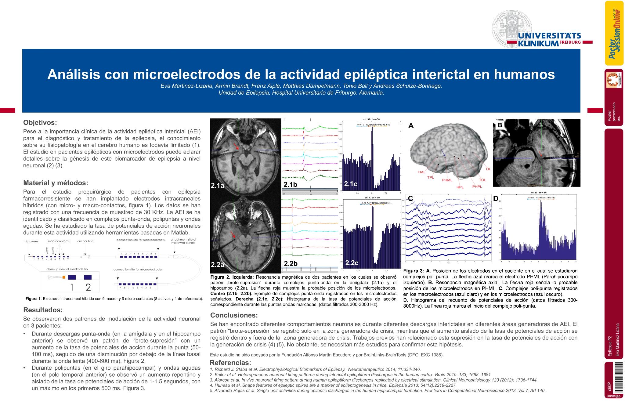 Análisis con microelectrodos de la actividad epiléptica interictal en humanos