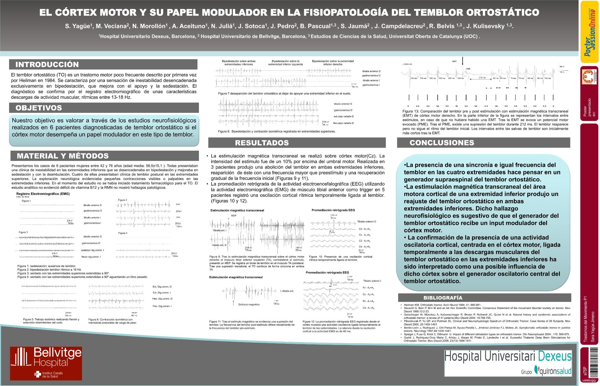 El córtex motor y su papel modulador en la fisiopatología del temblor ortostático