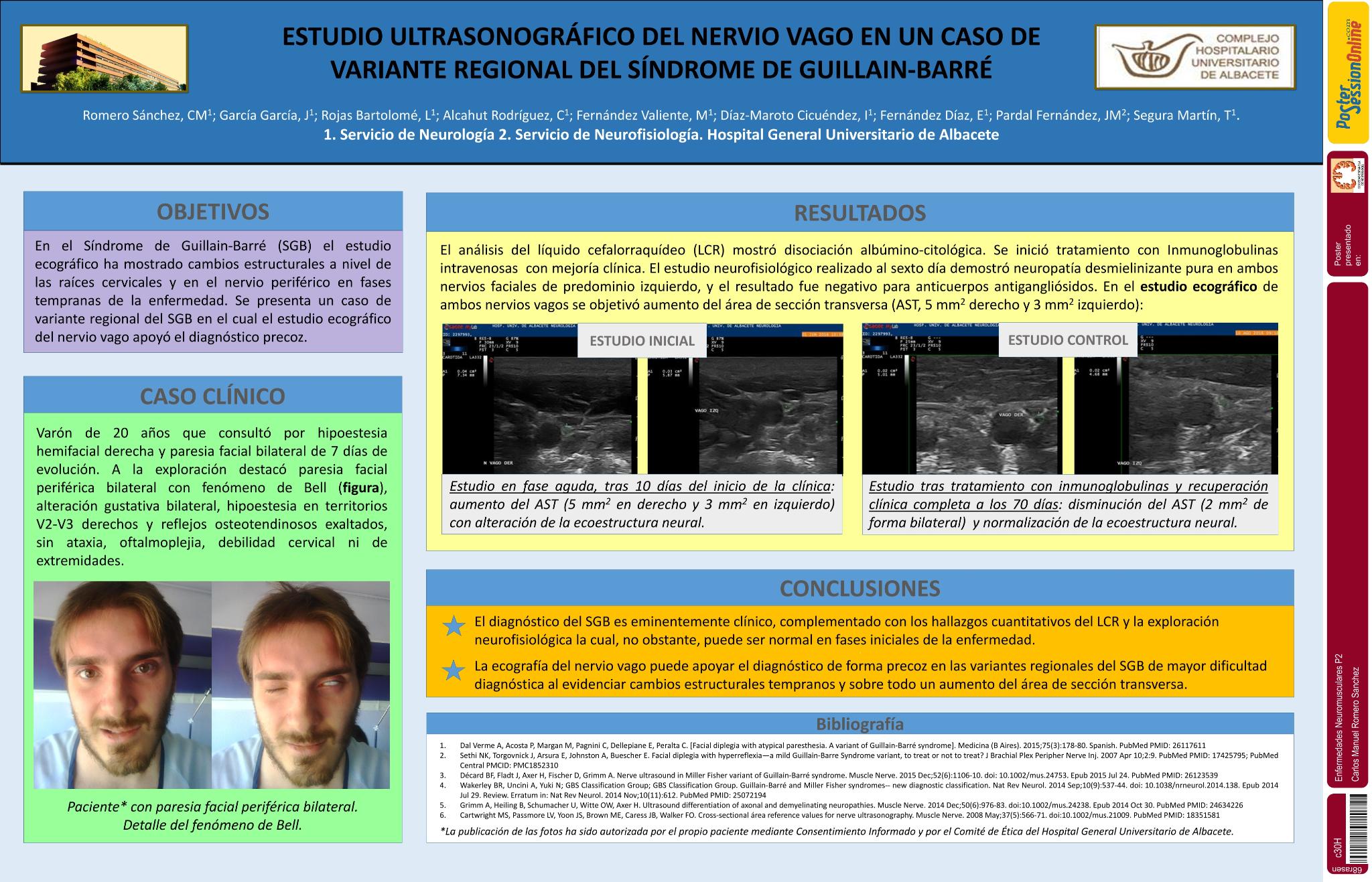Estudio ultrasonográfico del nervio vago en un caso de variante regional del Síndrome de Guillain-Barré