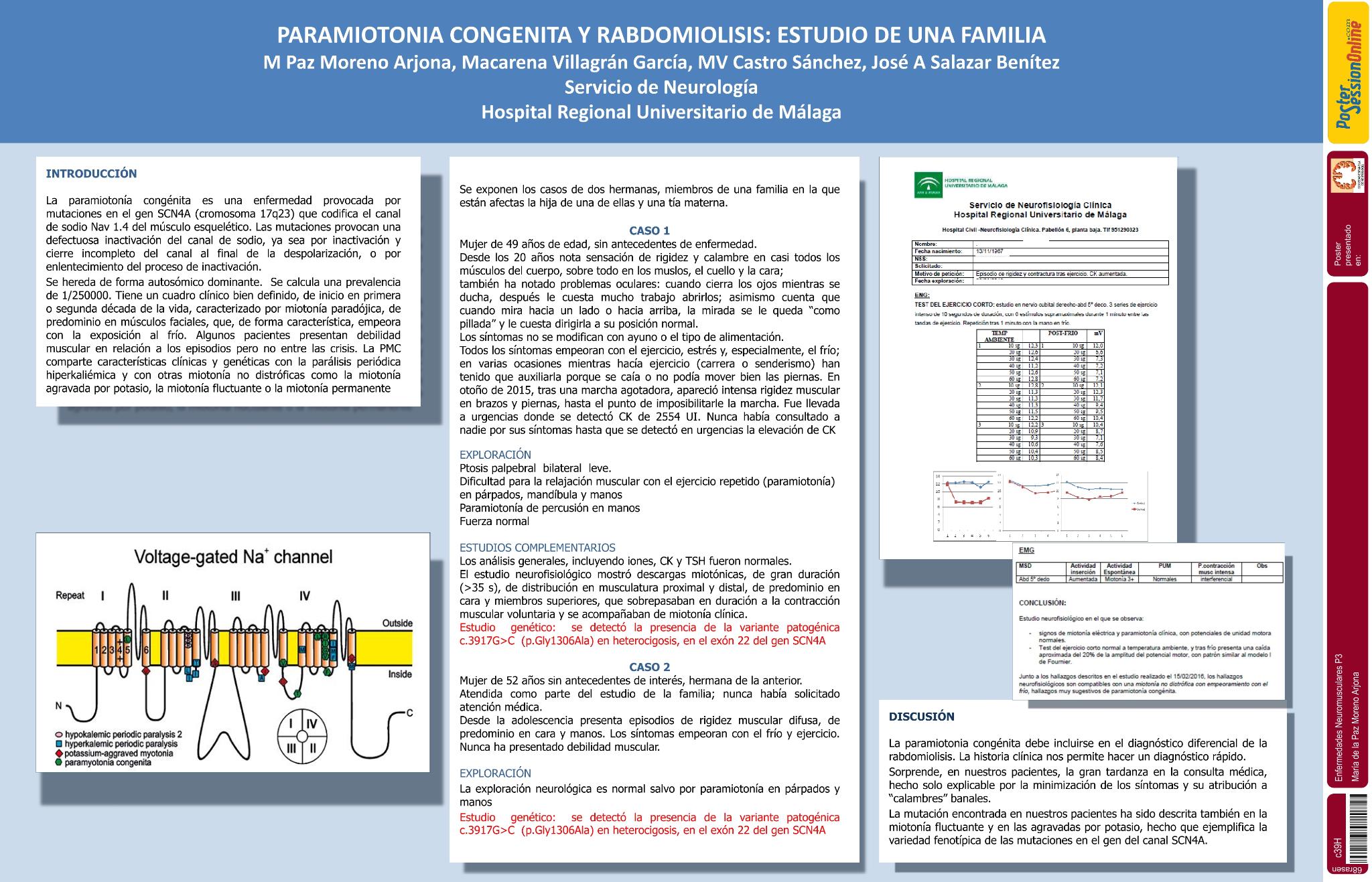 Paramiotonia congenita y rabdomiolisis. Estudio de una familia