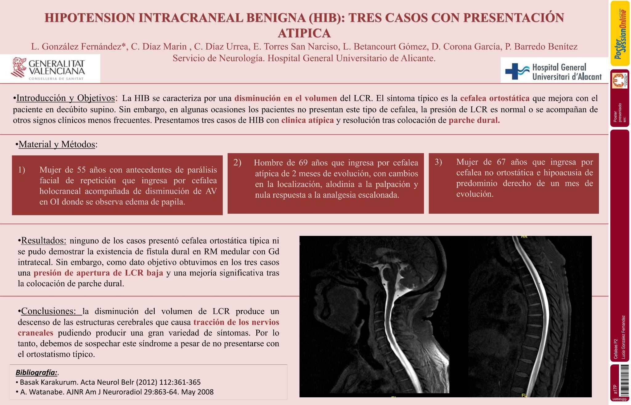 Hipotension Intracraneal Benigna (HIB): tres casos con presentación atipica