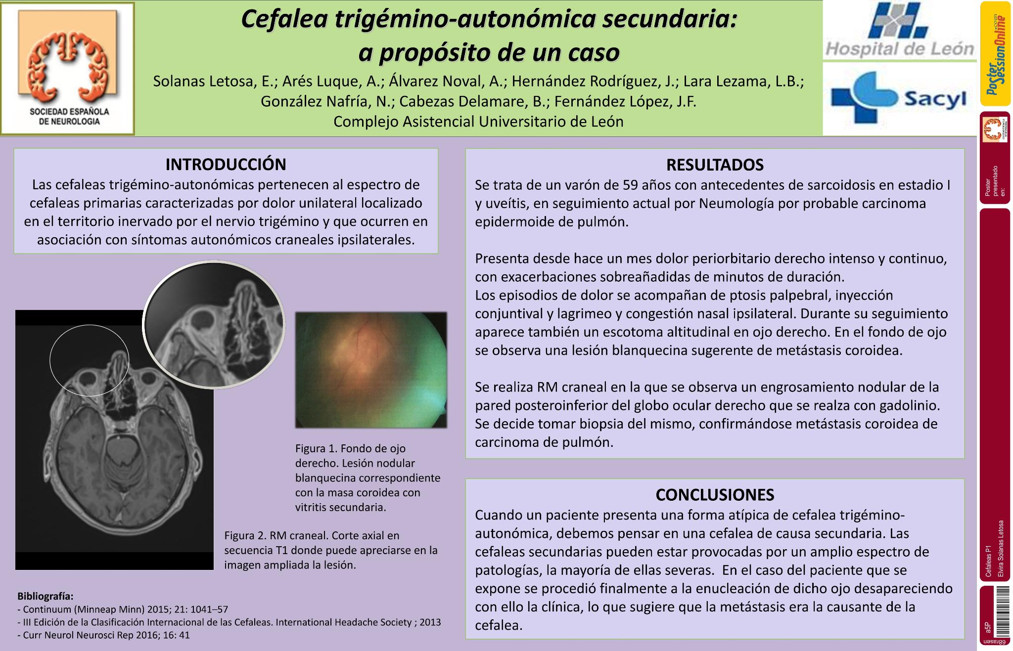 Cefalea trigémino-autonómica secundaria: A propósito de un caso