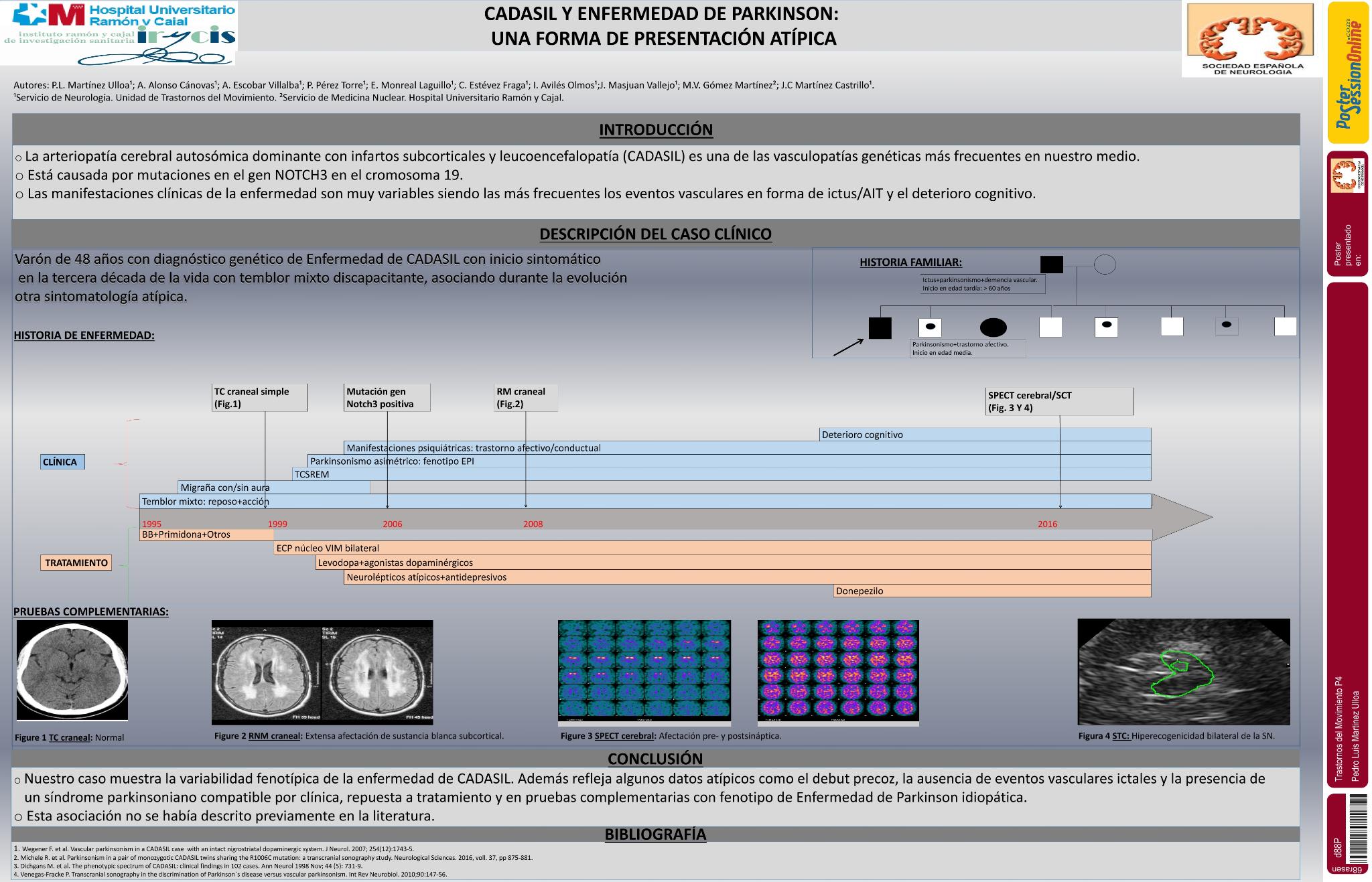 CADASIL y enfermedad de Parkinson: una forma de presentación atípica
