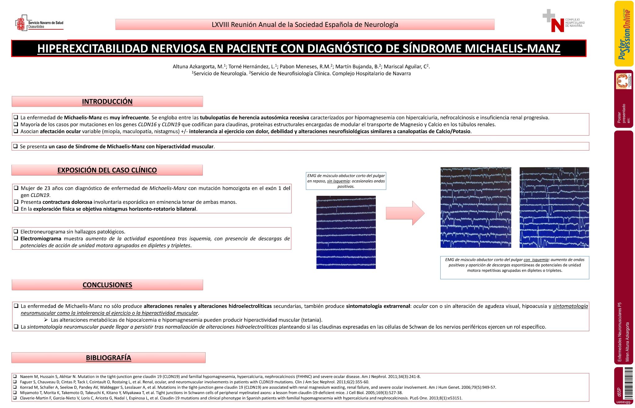Hiperexcitabilidad nerviosa en paciente con diagnóstico de Síndrome Michaelis-Manz