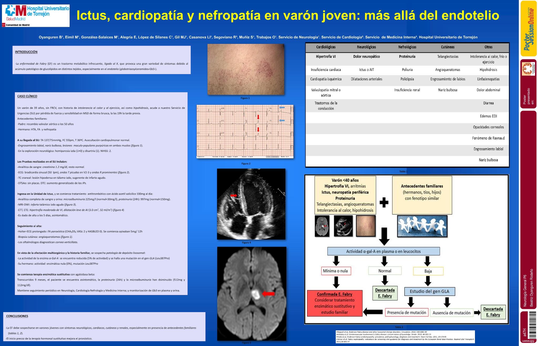Ictus, cardiopatía y nefropatía en varón joven: más allá del endotelio
