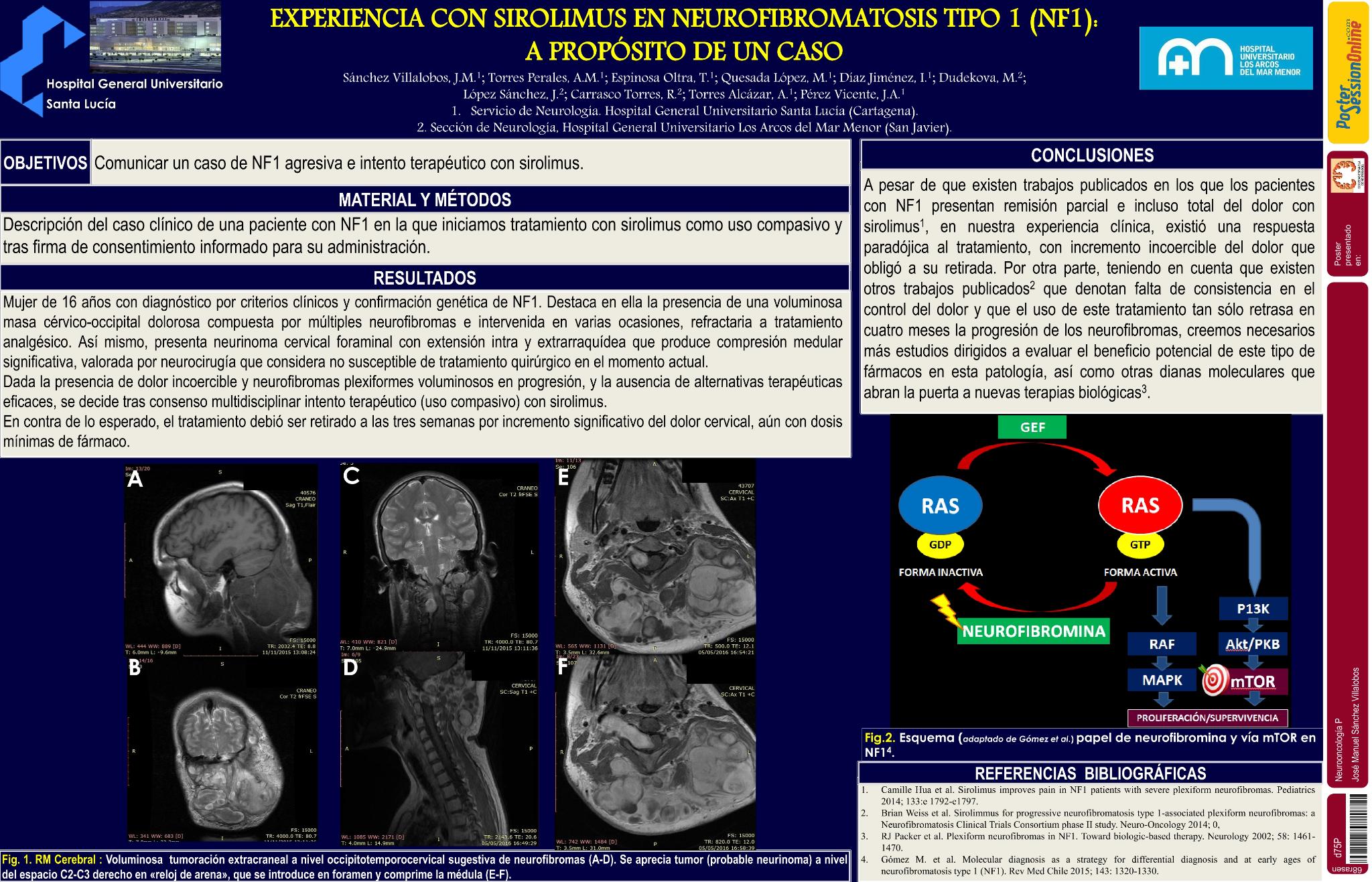 Experiencia con sirolimus en neurofibromatosis tipo 1 (NF1): a propósito de un caso