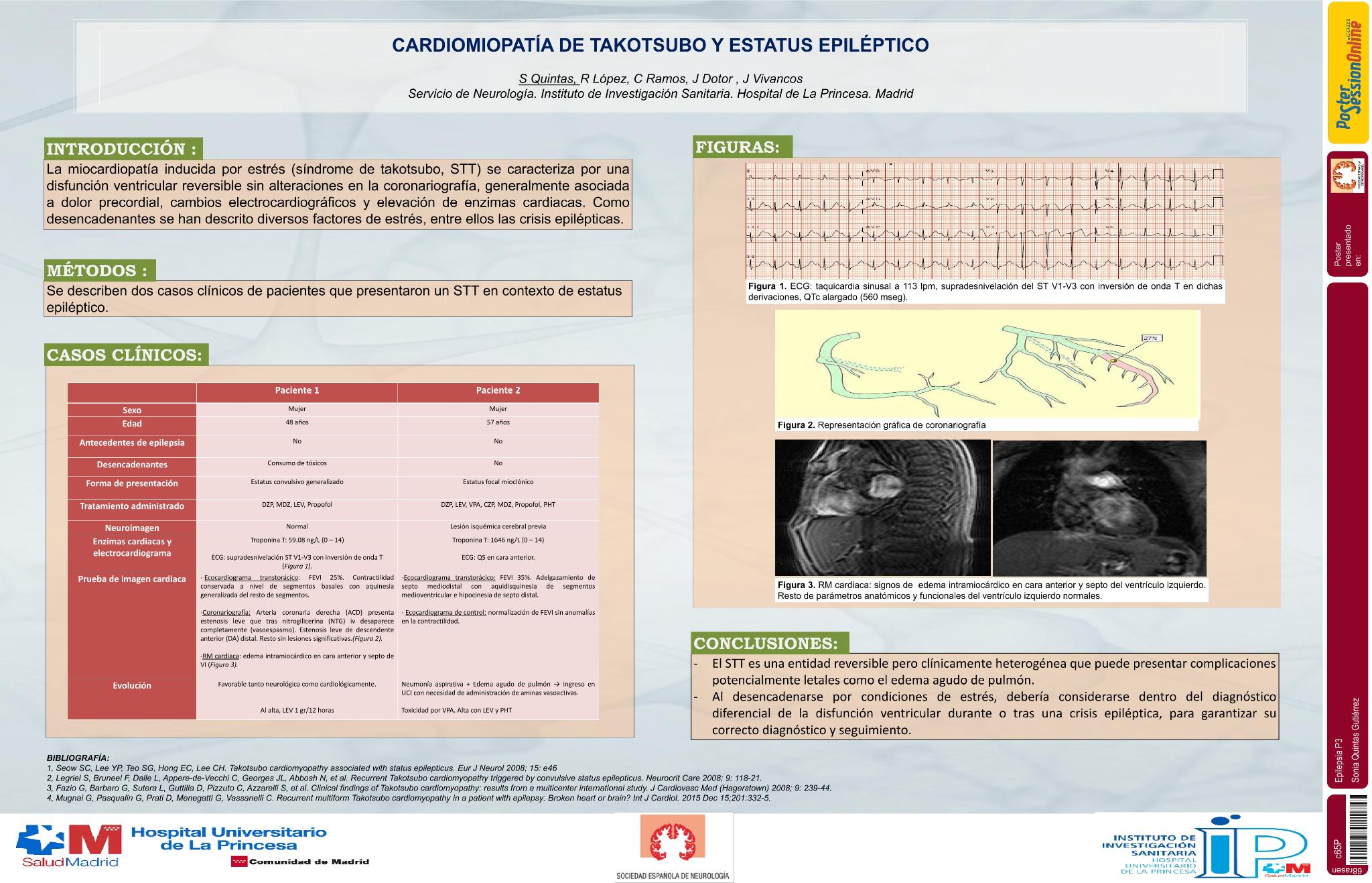 Cardiomiopatía de takotsubo y estatus epiléptico