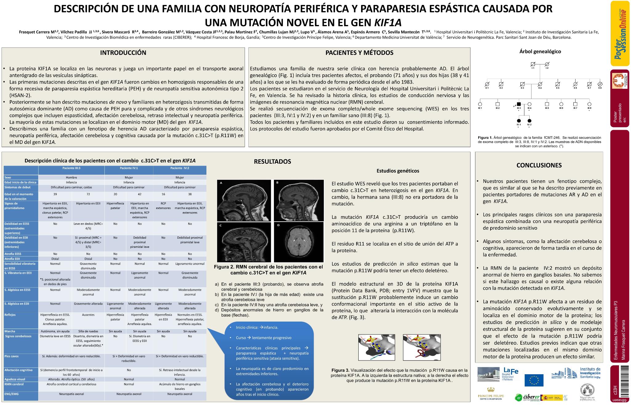Descripción de una familia con neuropatía periférica y paraparesia espástica causada por una mutacion novel en el gen KIF1A