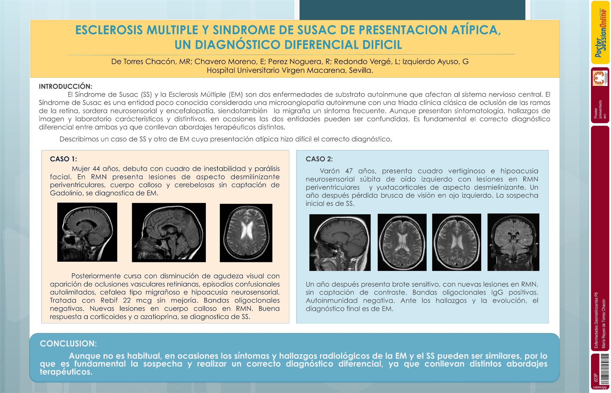 Esclerosis múltiple y síndrome de SUSAC de presentacion atípica, un dificil diagnóstico diferencial
