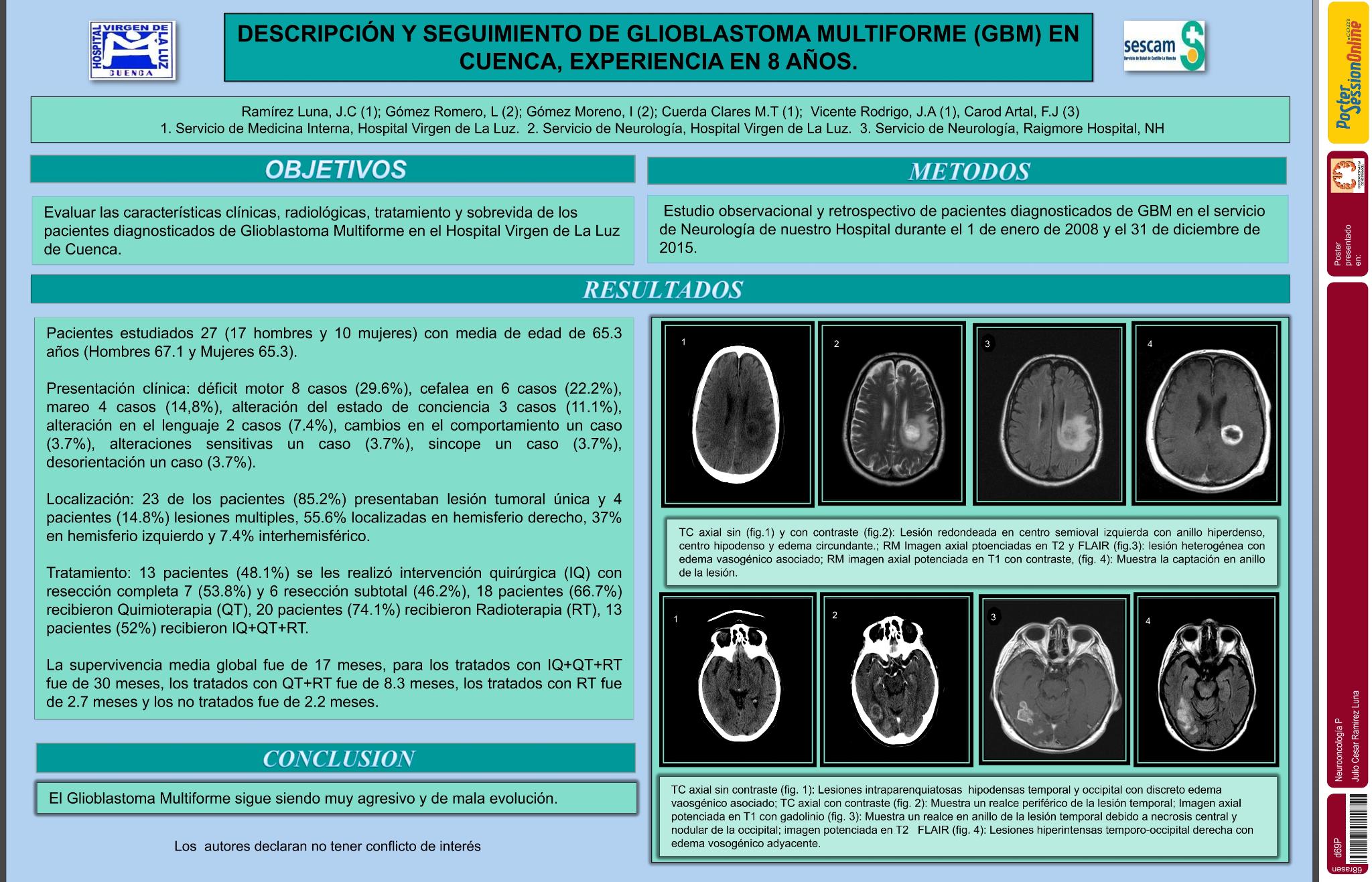 Descripción y seguimiento de Glioblastoma Multiforme (GBM) en Cuenca, experiencia en 8 años