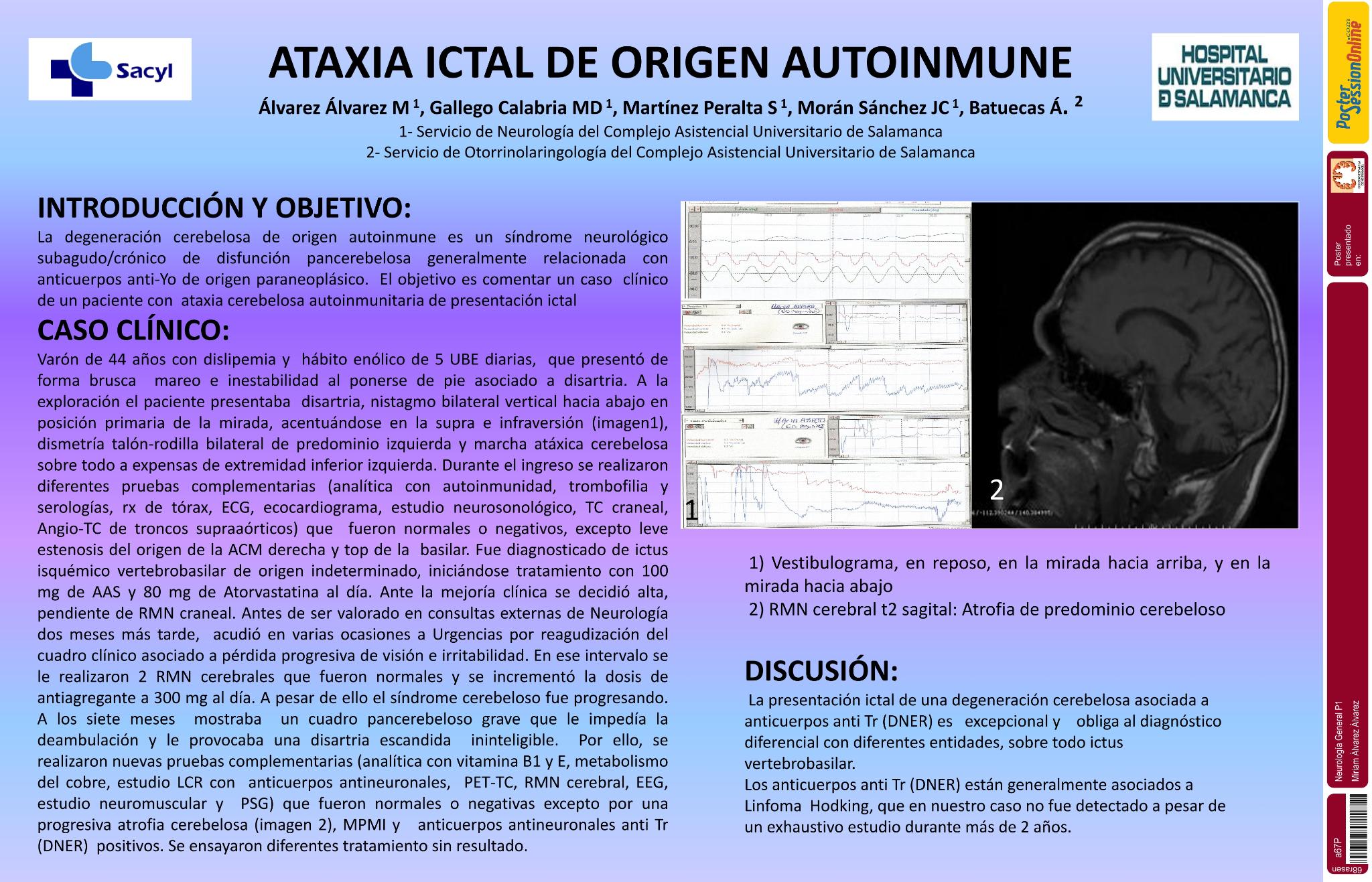 Ataxia ictal de origen autoinmune