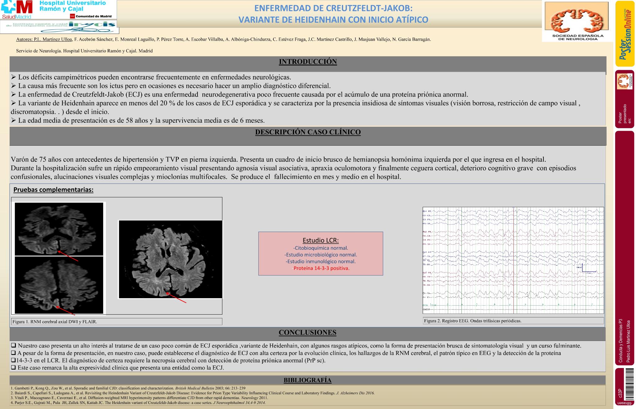 Enfermedad de Creutzfeldt-Jakob (ECJ) variante de heidenhain con inicio atípico