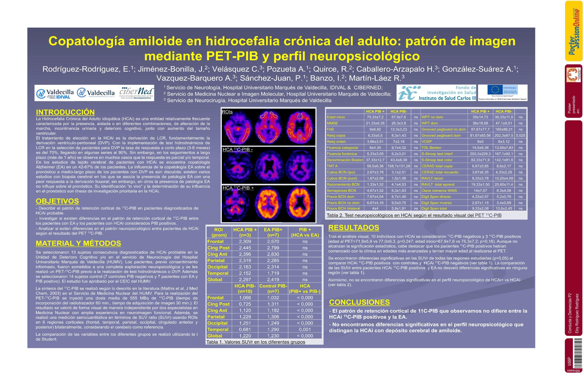 Copatología amiloide en hidrocefalia crónica del adulto: patrón de imagen mediante PET-PIB y perfil neuropsicológico