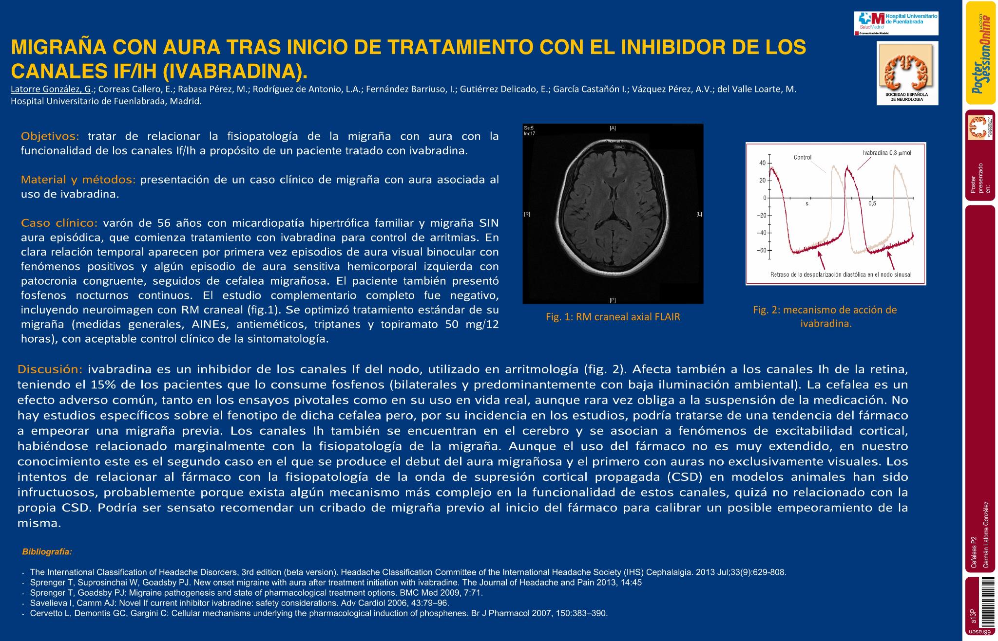 Migraña con aura tras inicio de tratamiento con el inhibidor de los canales IF/IH, ivabradina
