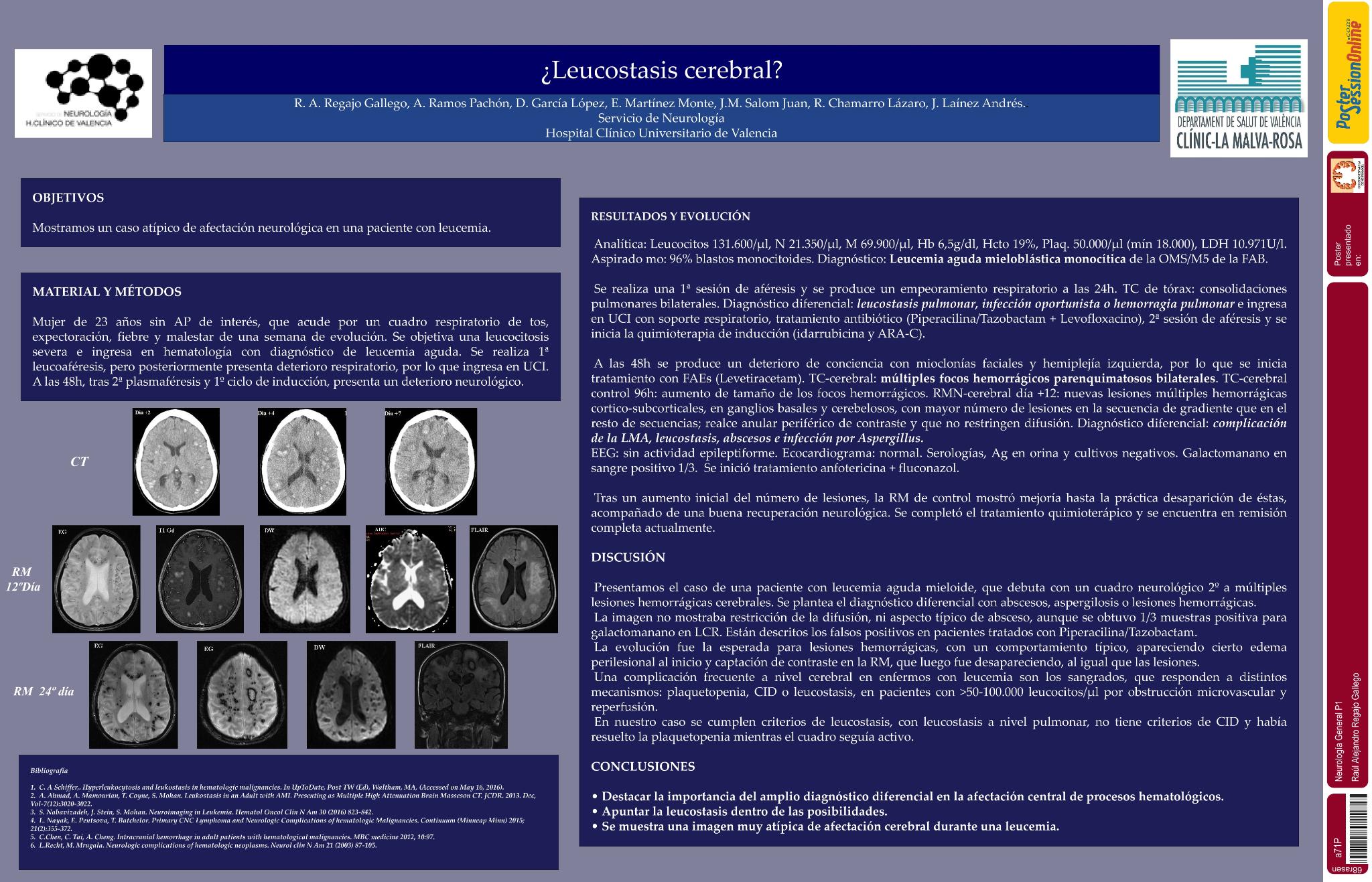¿Leucostasis cerebral?