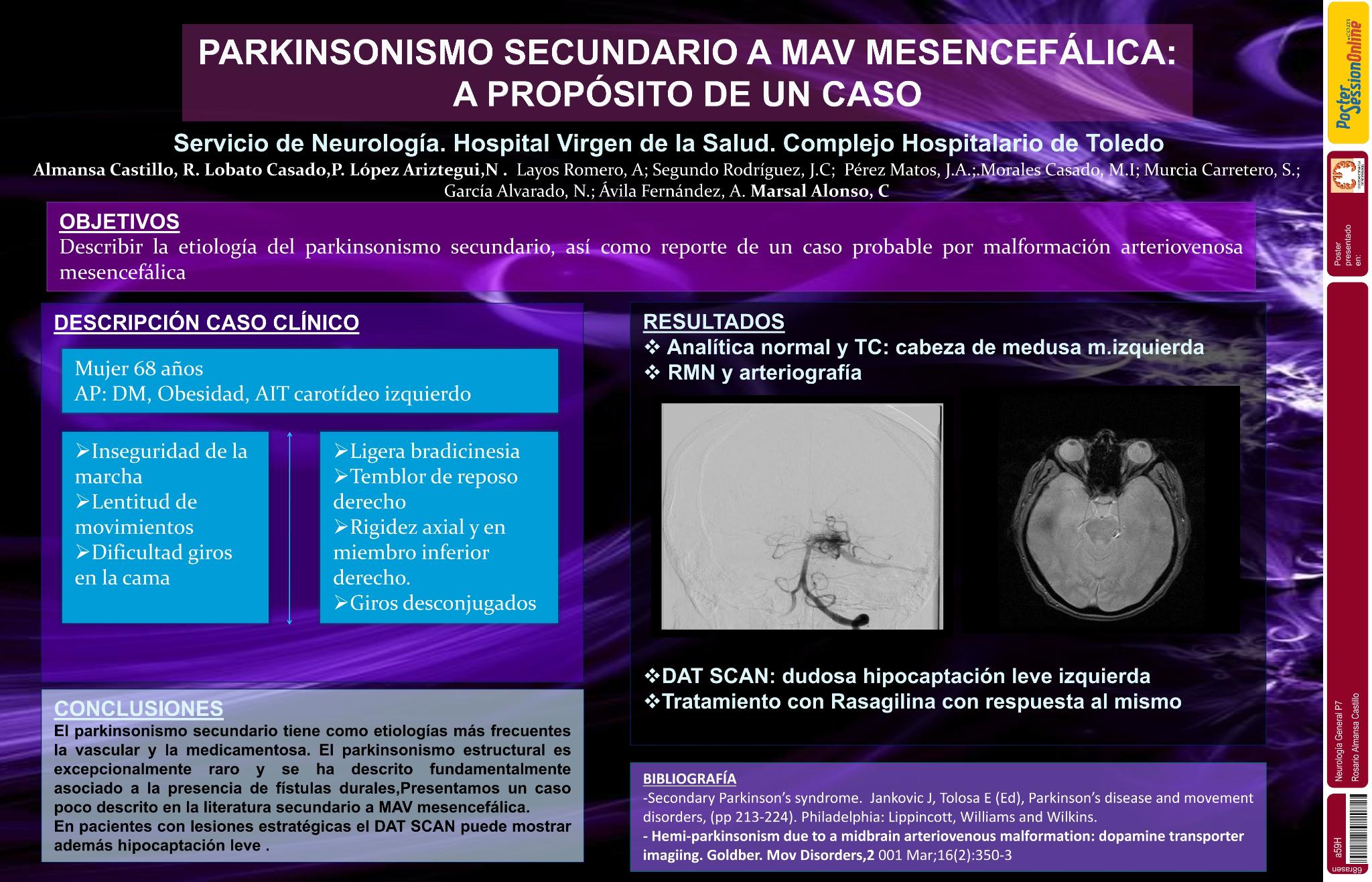 Parkinsonismo secundario a malformación arteriovenosa mesencefálica: a propósito de un caso