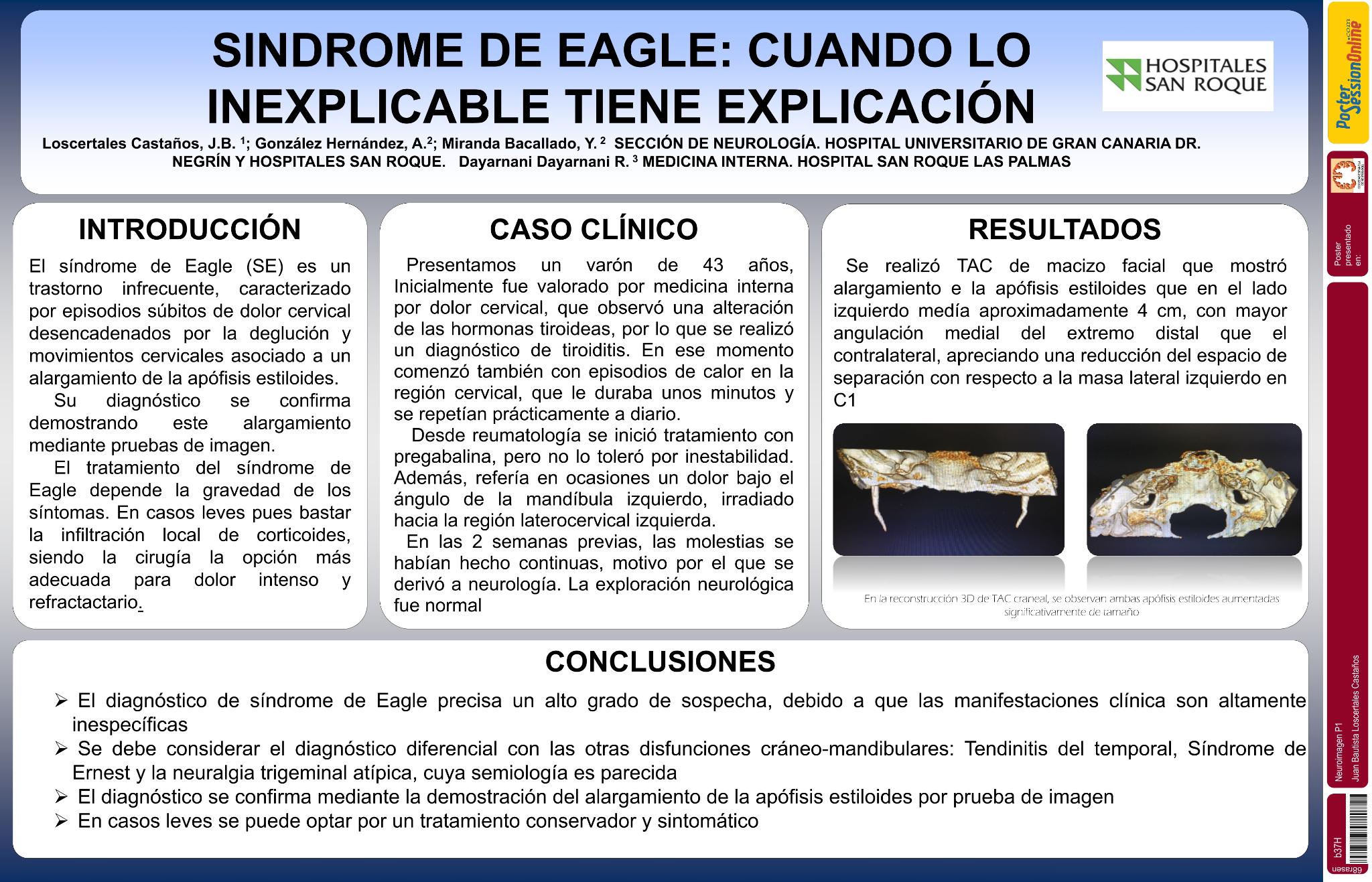 Síndrome de Eagle: cuando lo inexplicado tiene una explicación