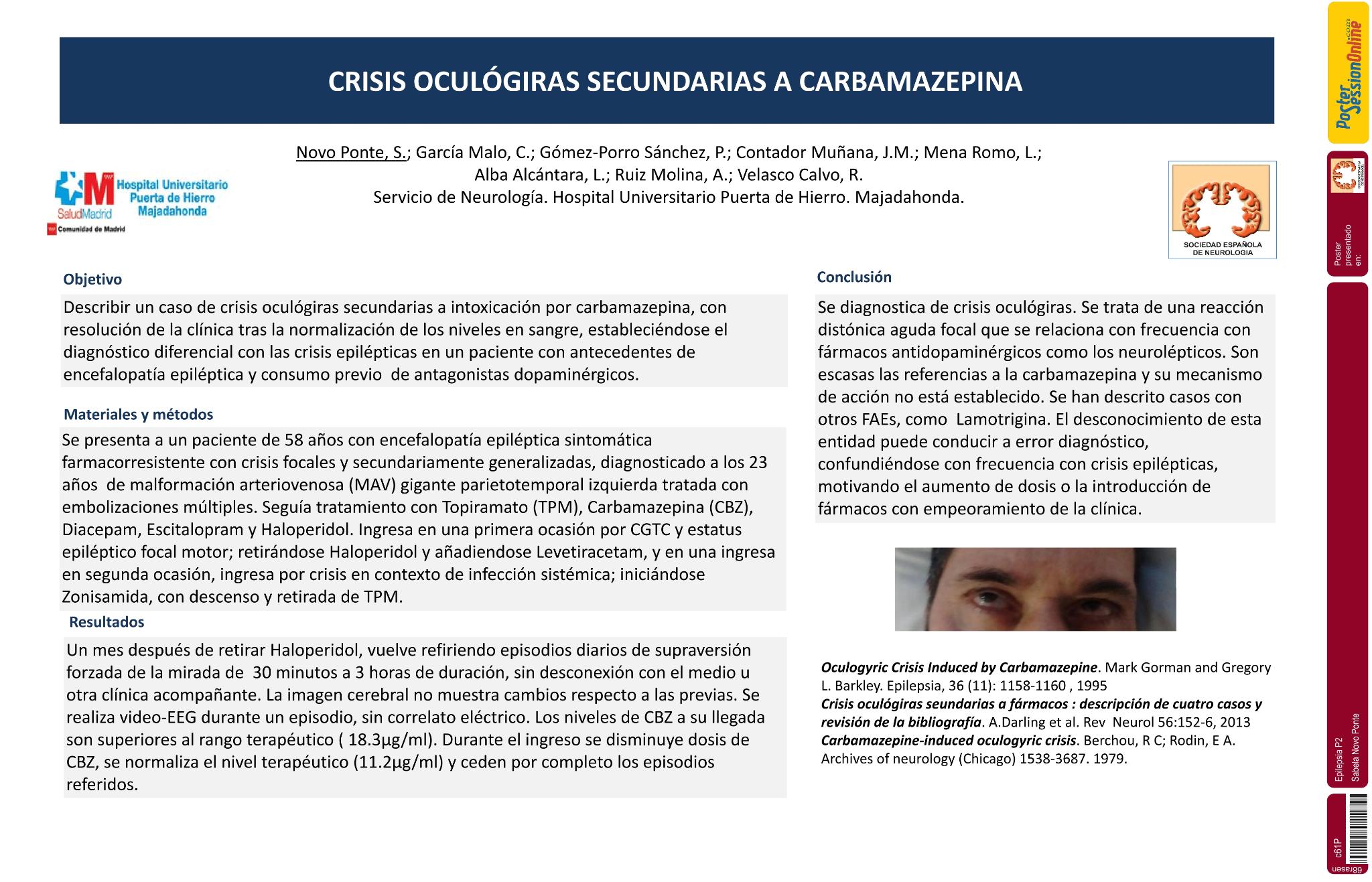 Crisis oculógiras secundarias a carbamazepina