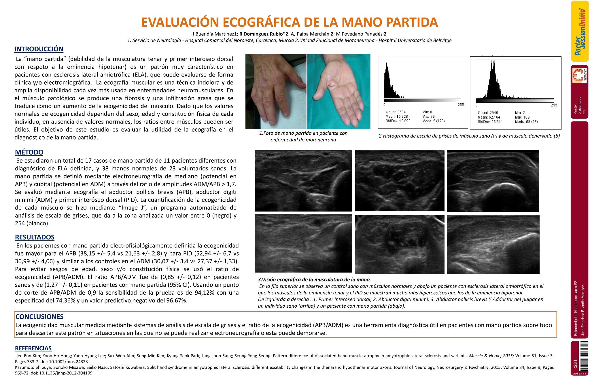 Estudio ecográfico de la mano partida