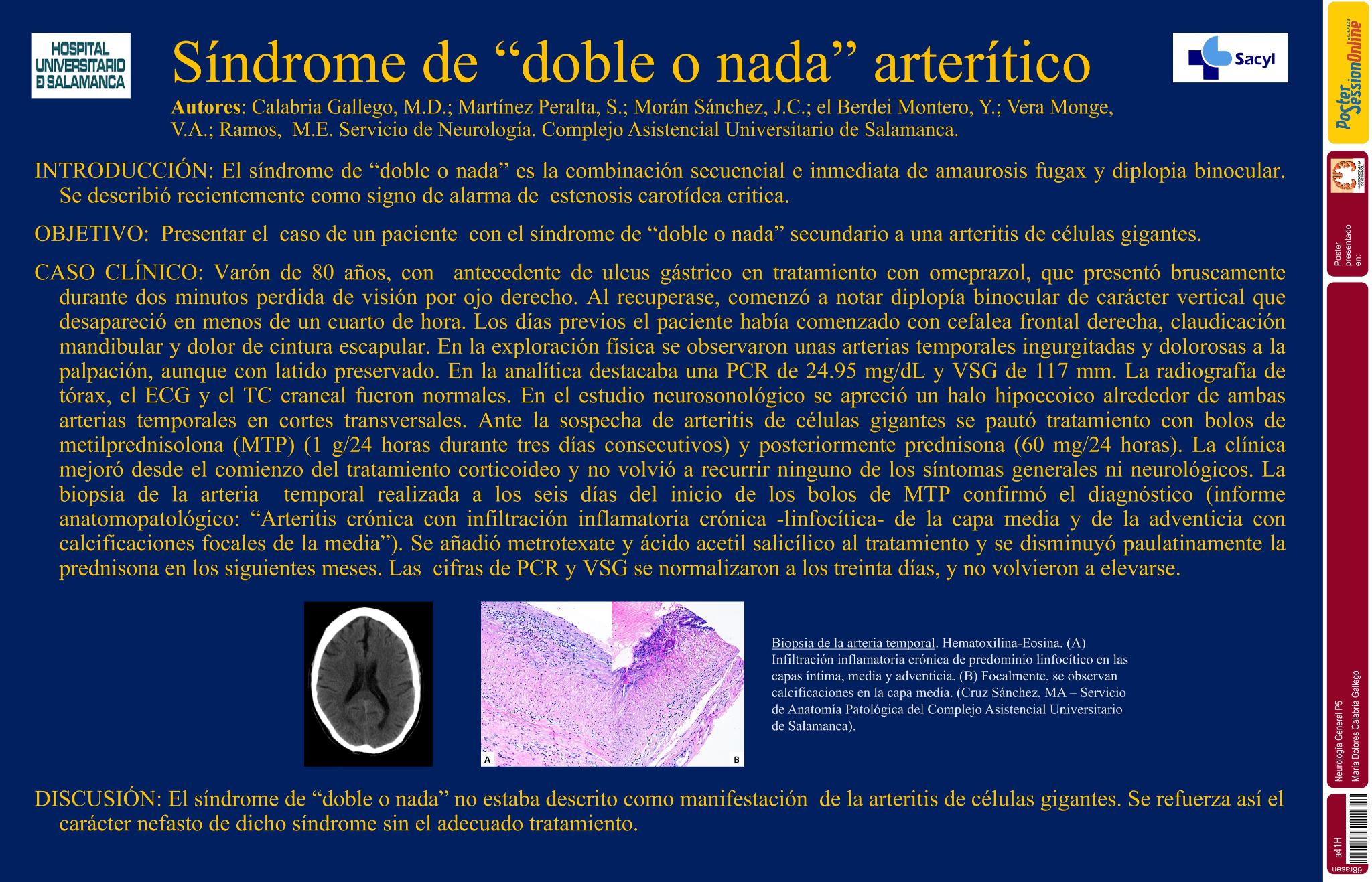 "Síndrome de doble o nada" arterítico