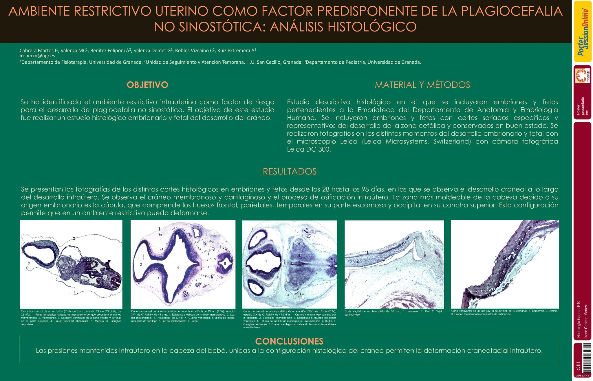 Ambiente restrictivo uterino como factor predisponente de la plagiocefalia no sinostótica: análisis histológico