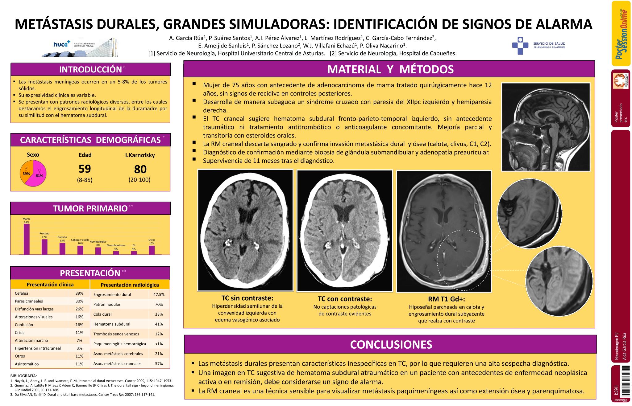 Metástasis durales, grandes simuladoras: identificación de signos de alarma