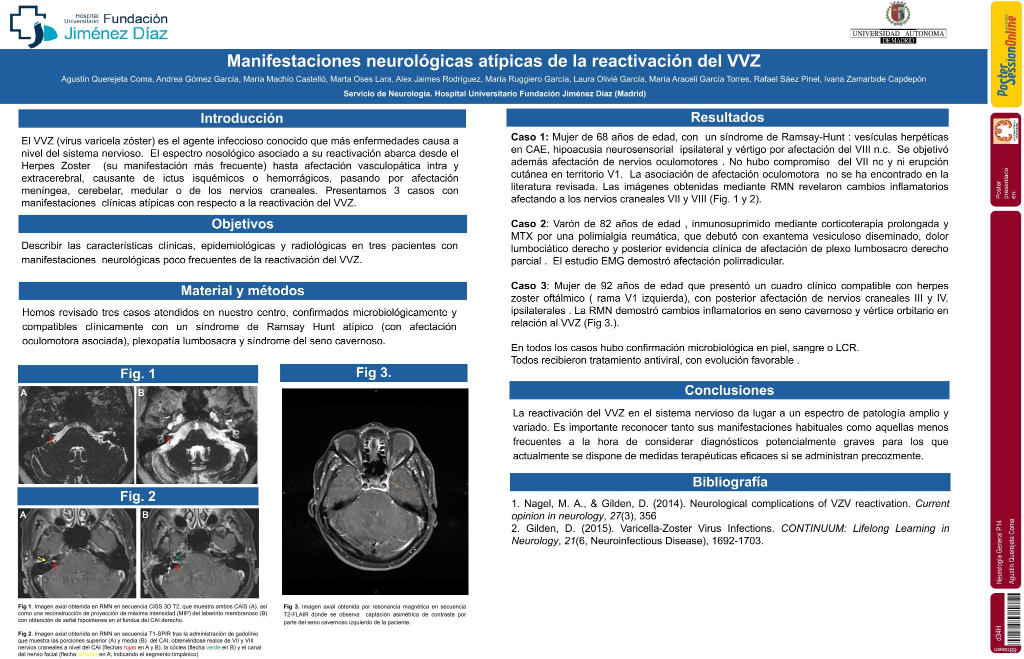 Manifestaciones neurológicas inusuales de la reactivación del virus varicela zóster