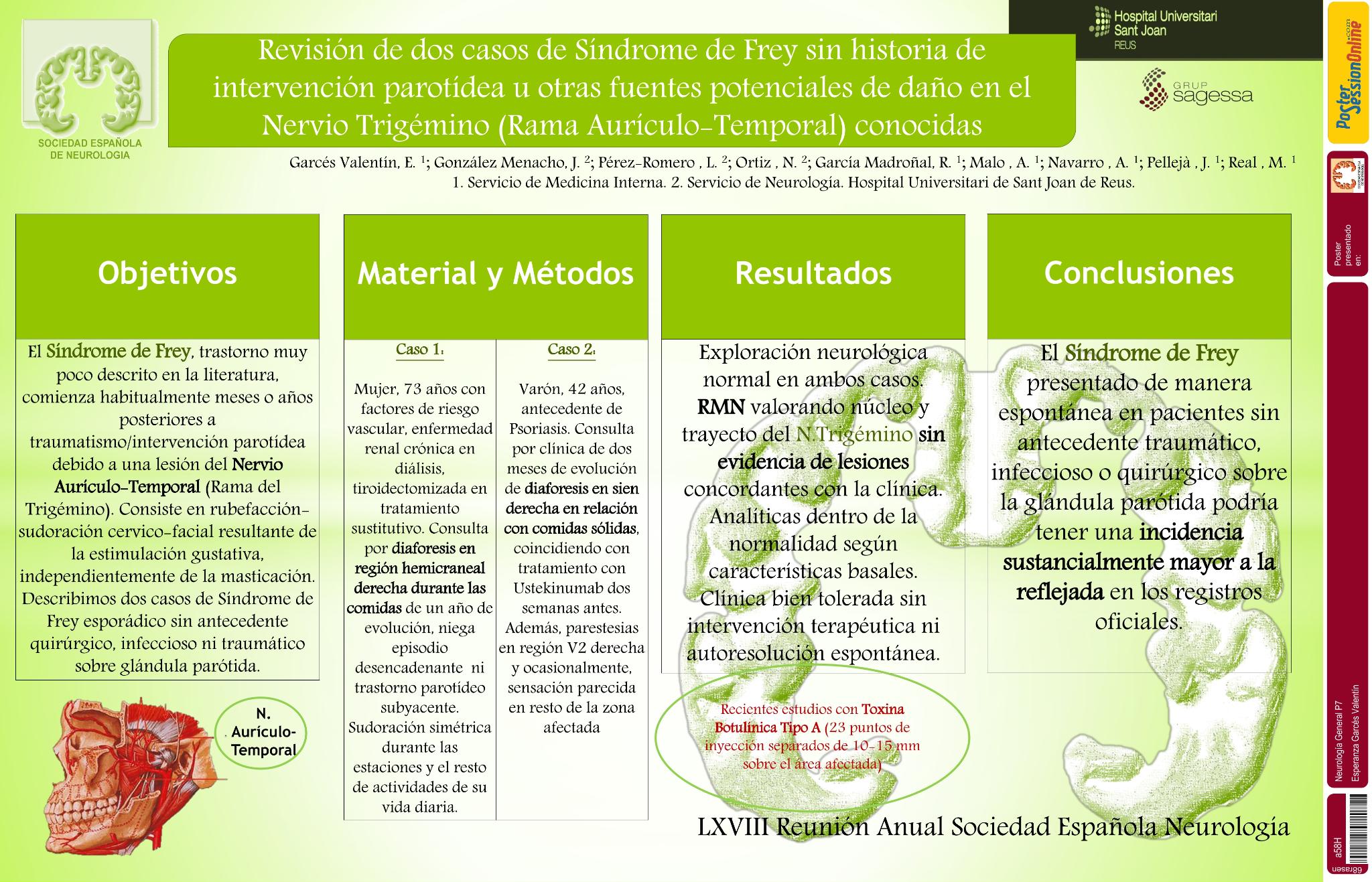 Revisión de dos casos de Síndrome de Frey sin historia de intervención parotídea u otras fuentes potenciales de daño en el Nervio Trigémino (Rama Aurículo-Temporal) conocidas