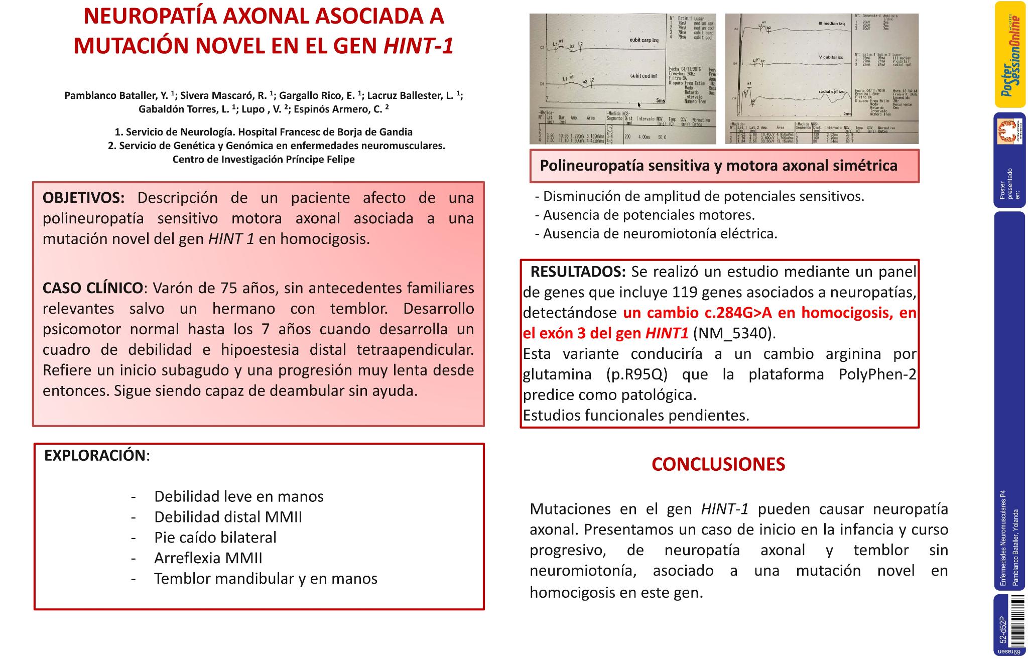 Neuropatía axonal asociada a mutación novel en el gen HINT 1