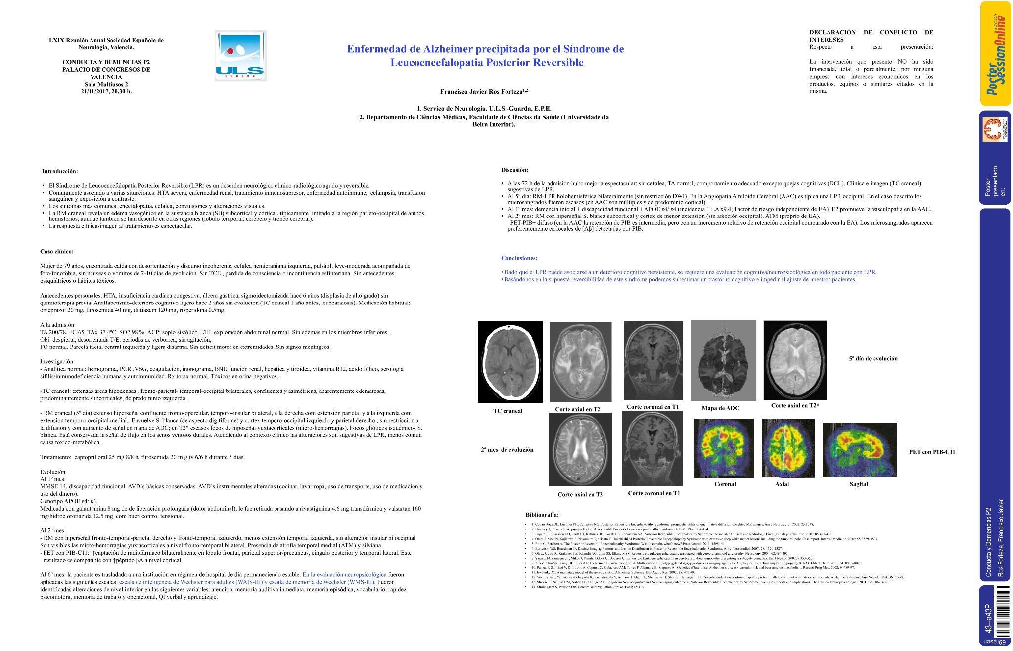 Enfermedad de Alzheimer precipitada por el síndrome de Leucoencefalopatia Posterior Reversible