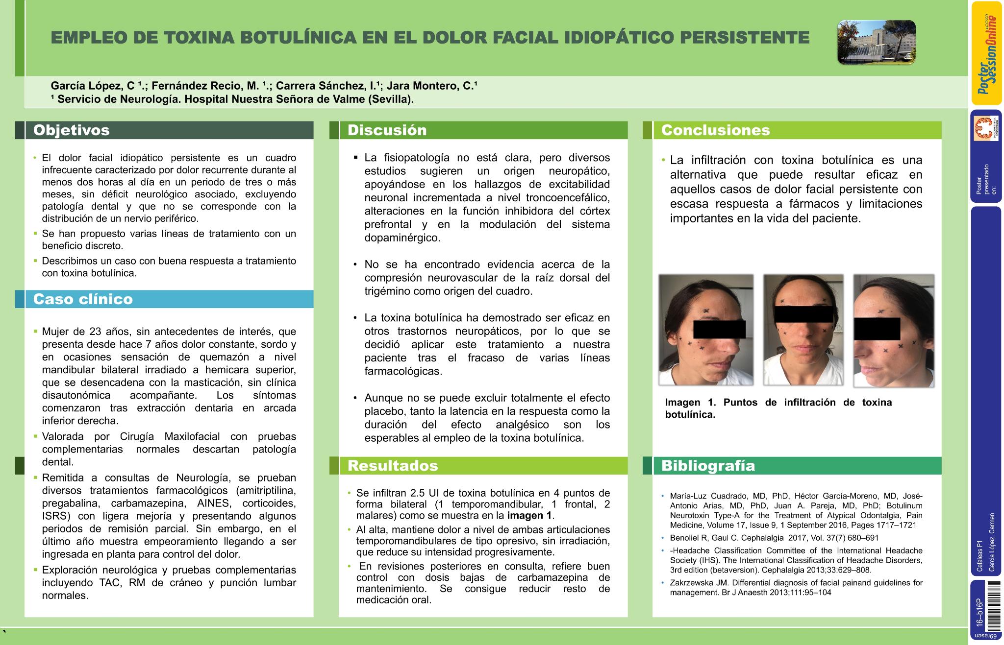 Empleo de toxina botulínica en el dolor facial idiopático persistente