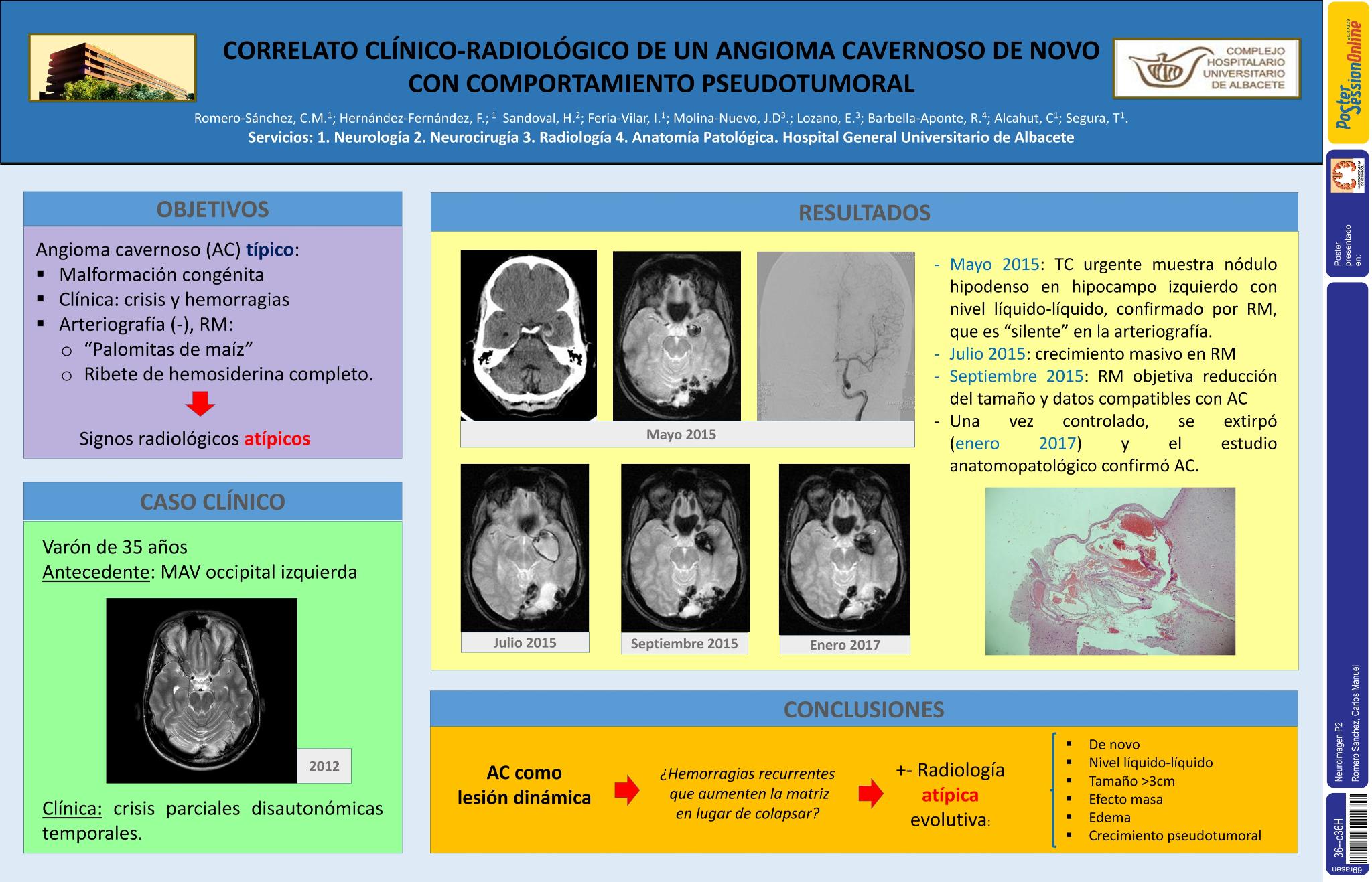 Correlato clínico-radiológico de un angioma cavernoso de novo con comportamiento pseudotumoral
