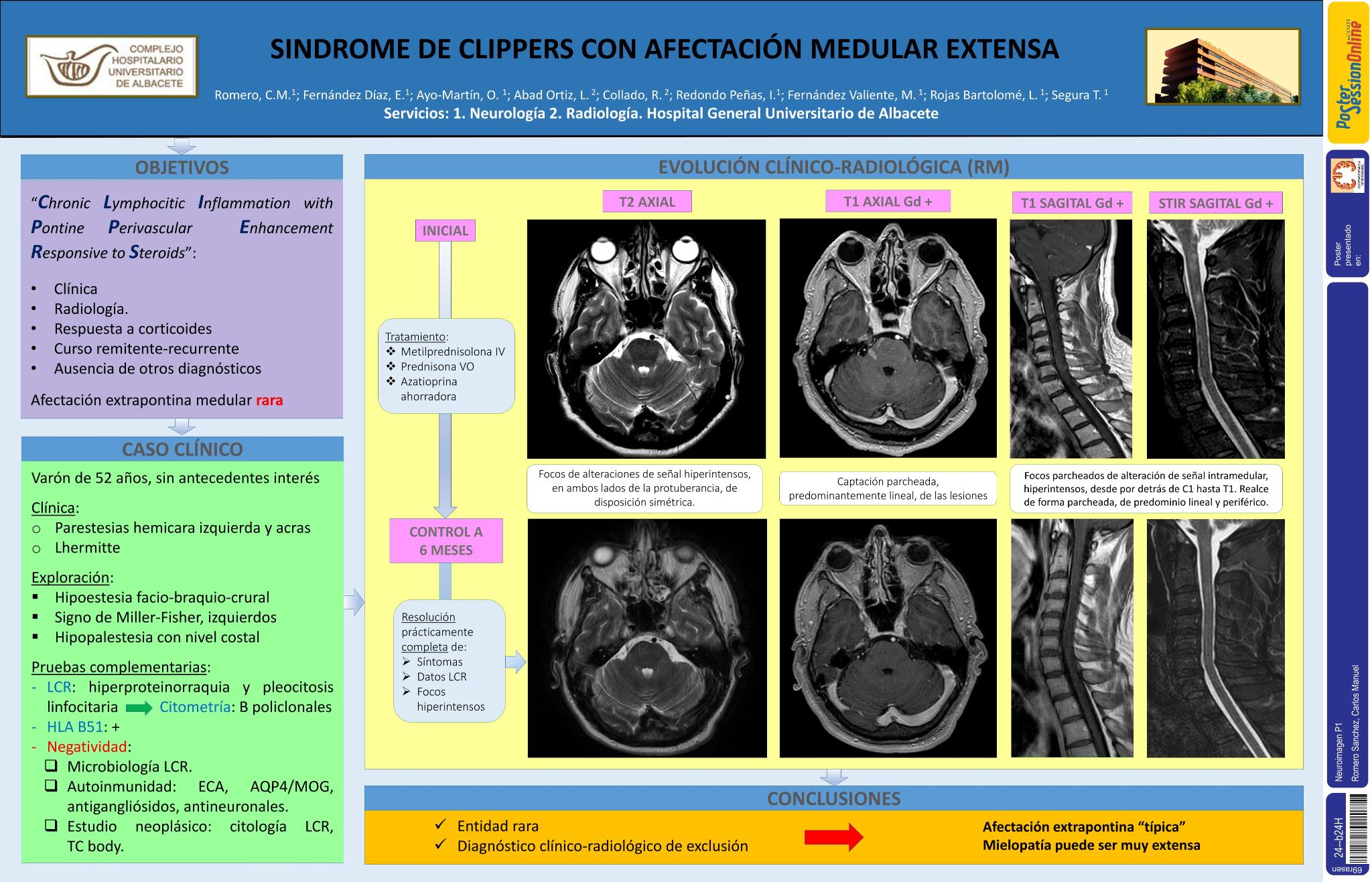 Síndrome de CLIPPERS con afectación medular extensa
