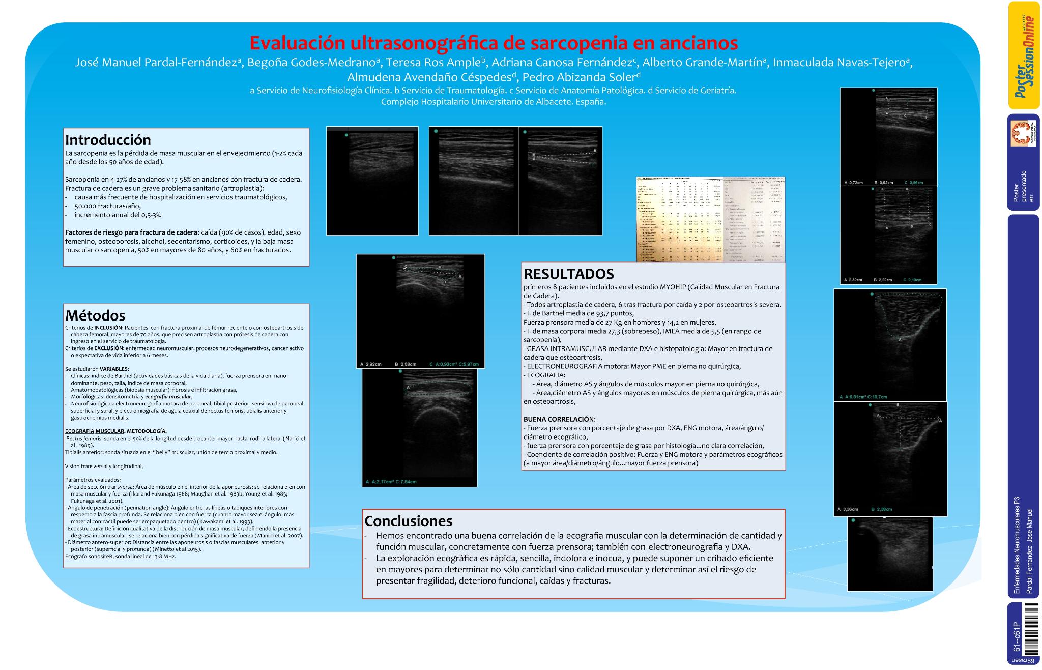 Evaluación ultrasonográfica de sarcopenia en ancianos