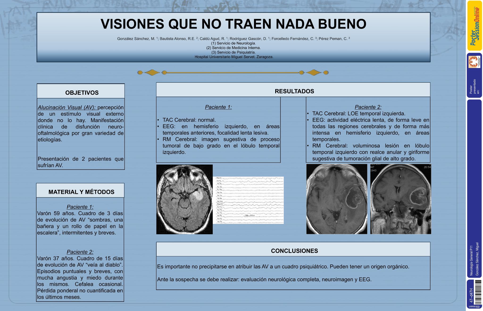 Visiones que no traen nada bueno