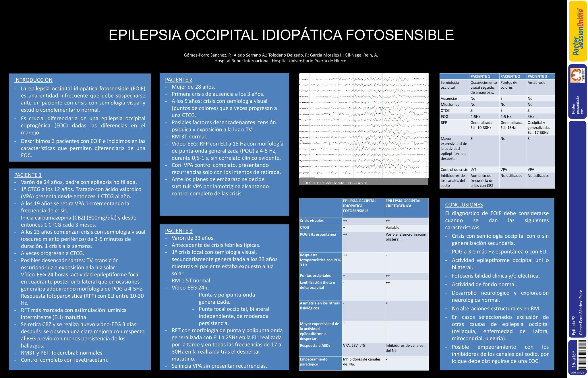 Epilepsia occipital idiopática fotosensible o epilepsia generalizada idiopática con semiología occipital