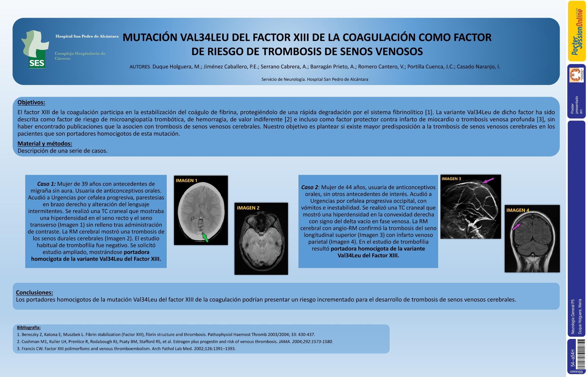 Mutación Val34Leu del Factor XIII de la coagulación como factor de riesgo de trombosis de senos venosos
